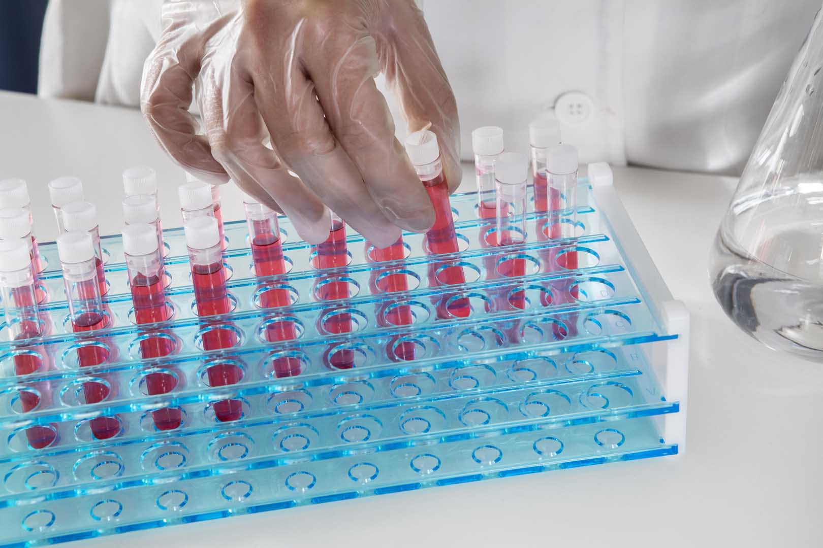 ACTH (Adrenokortikotropik Hormon) Testi