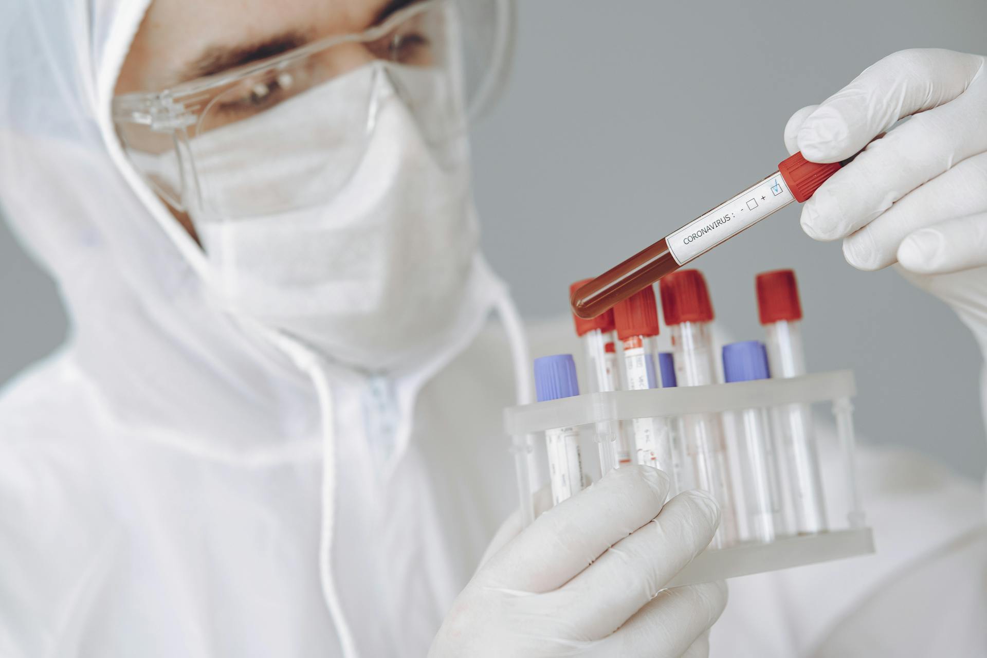 Akut Miyeloid Lösemi (AML)