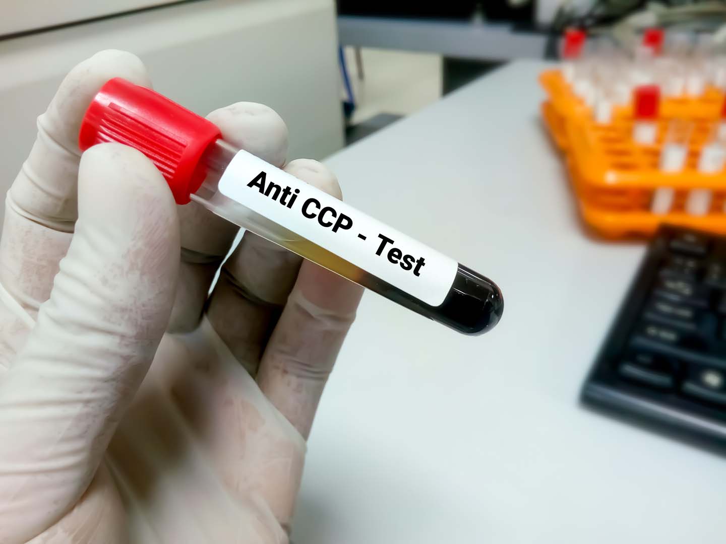 Anti CCP Testi