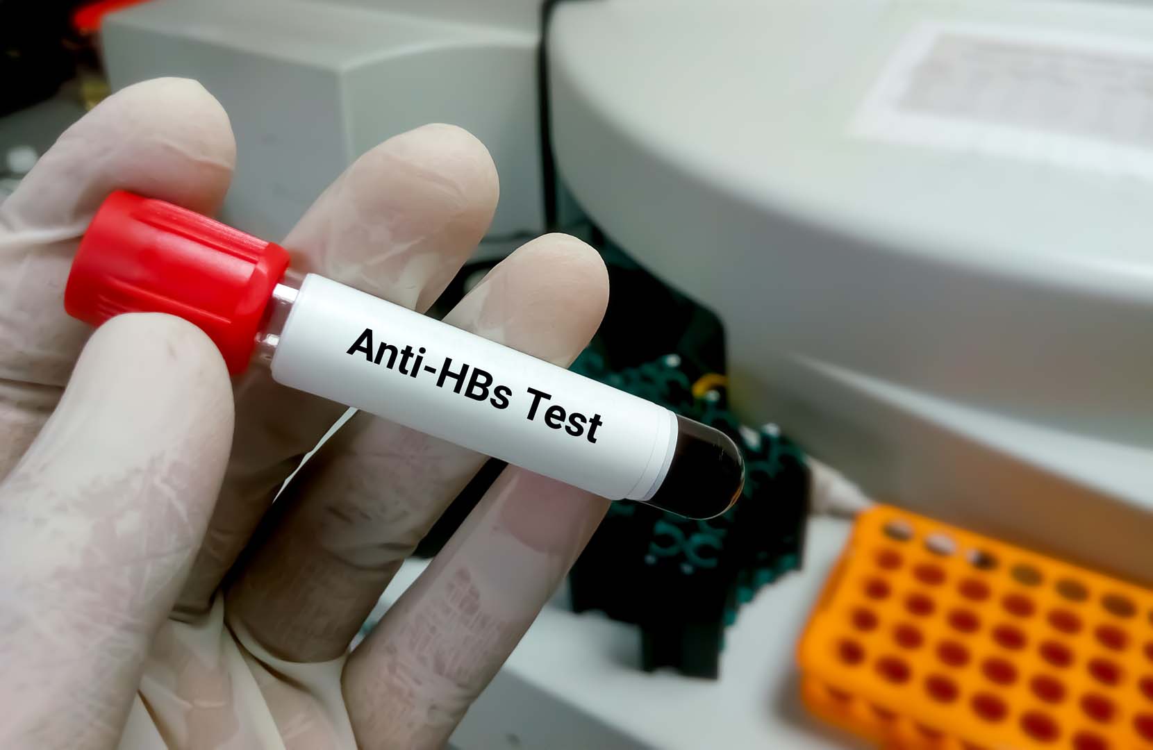 Anti HBs Testi