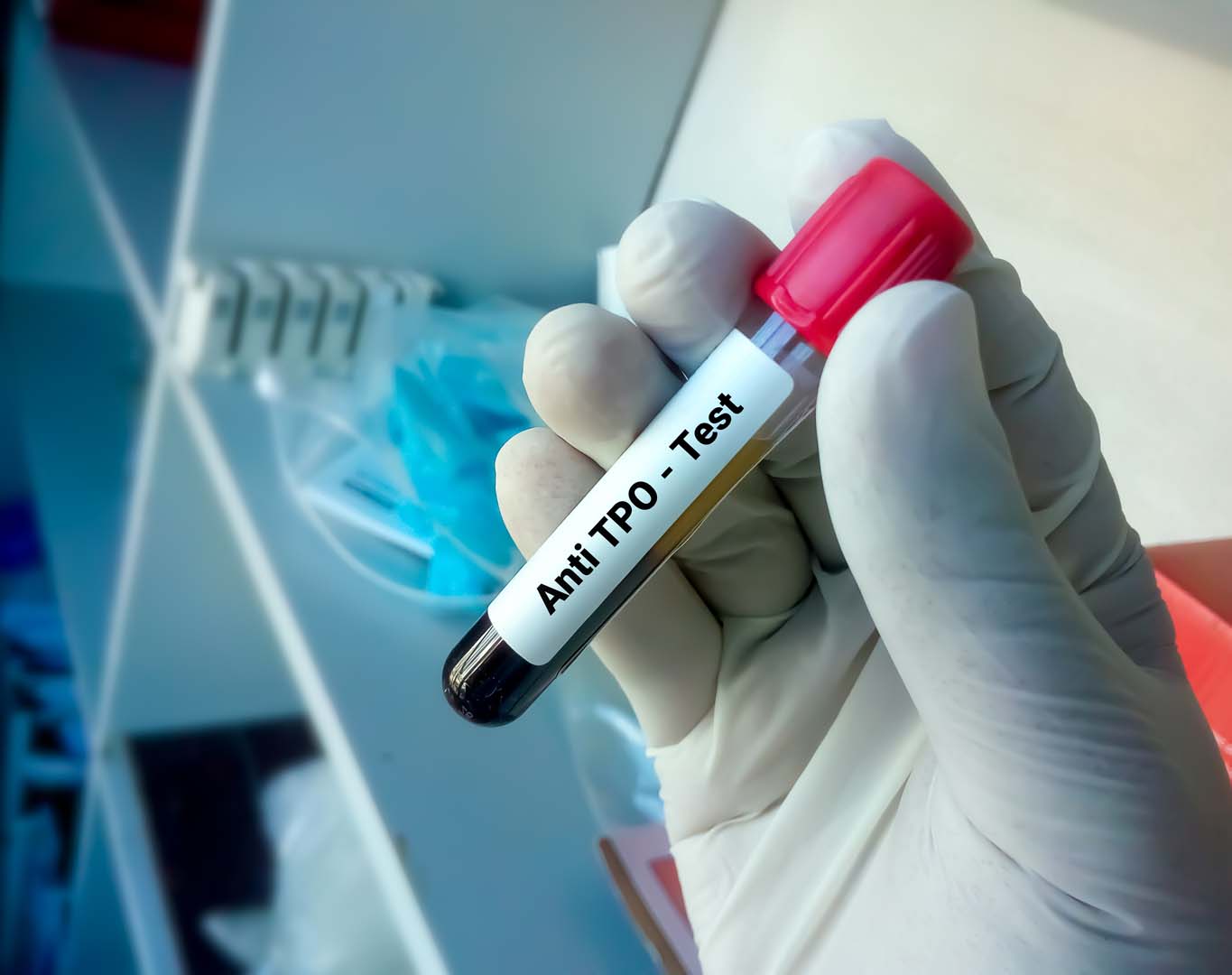 Anti TPO Testi