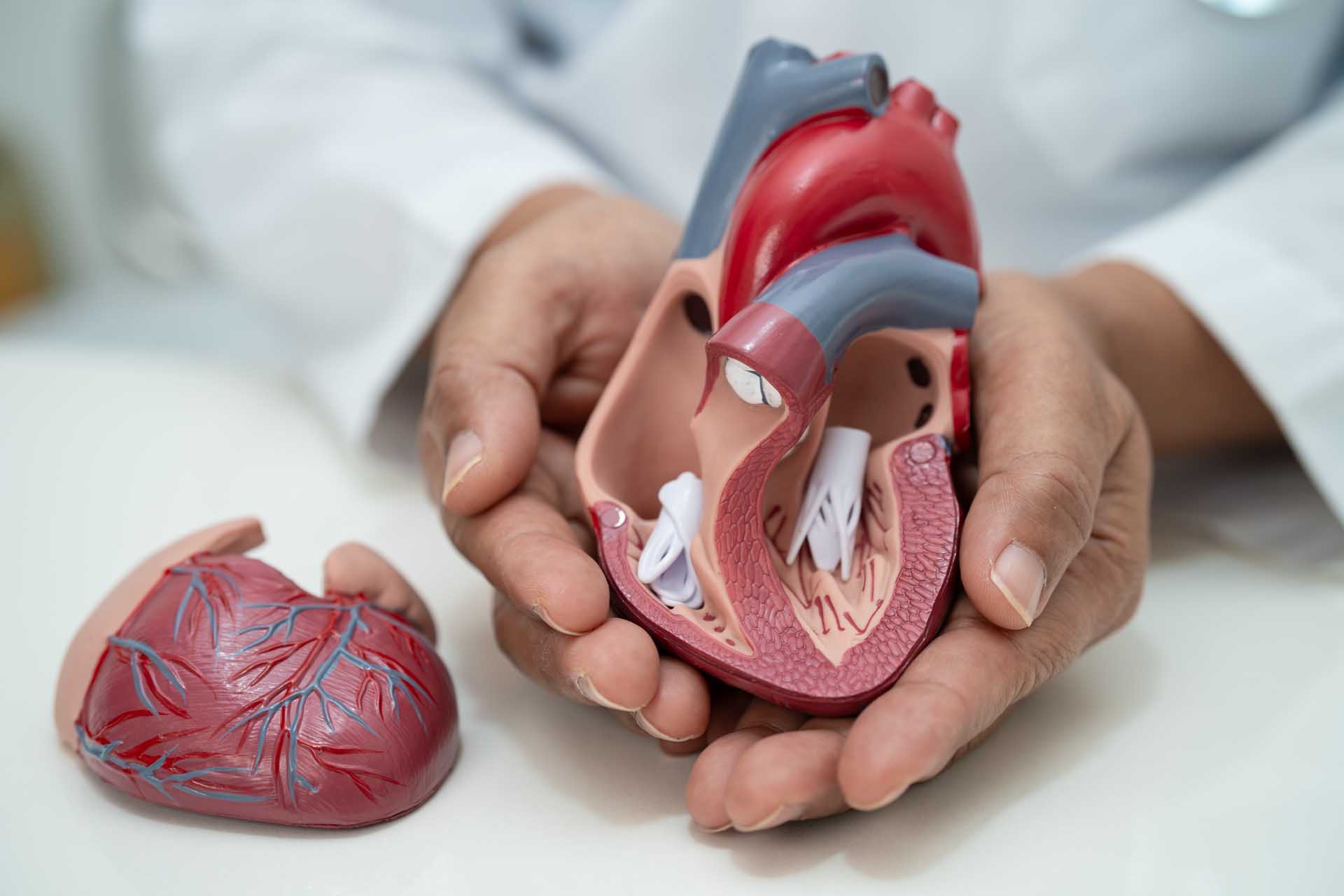 ASD (Atriyal Septal Defekt)