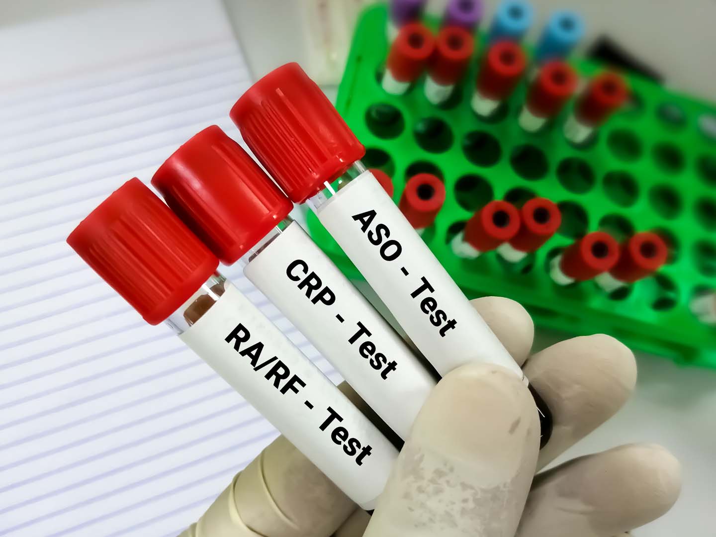 ASO Testi