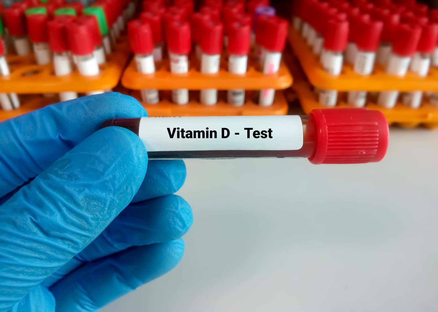B12 Vitamini Testi