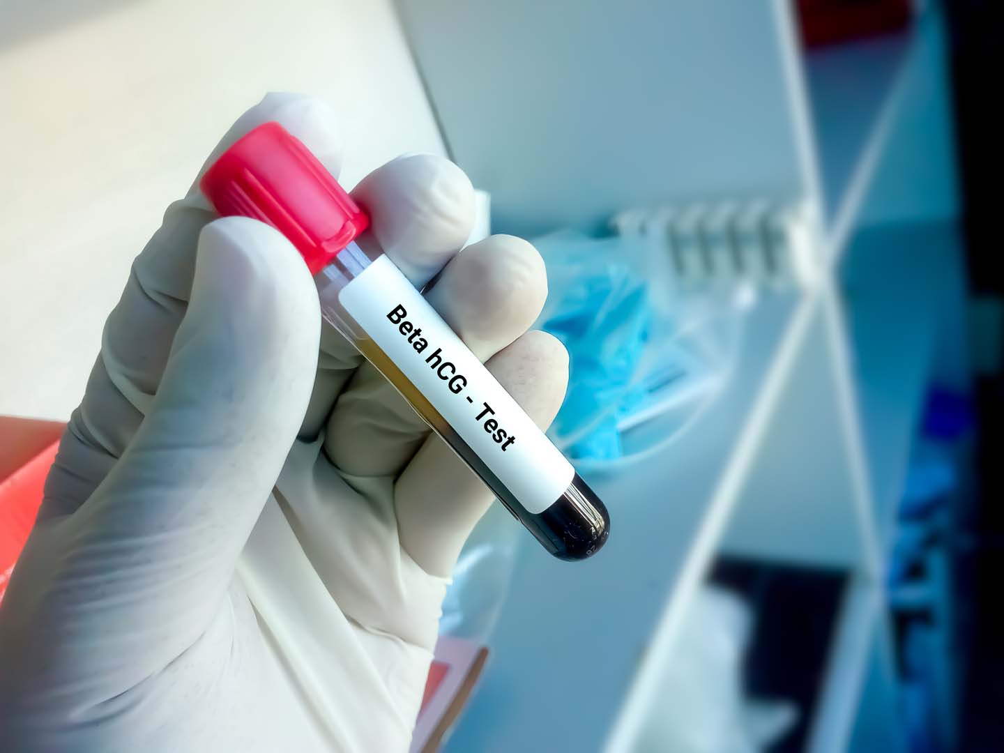 Beta HCG Testi