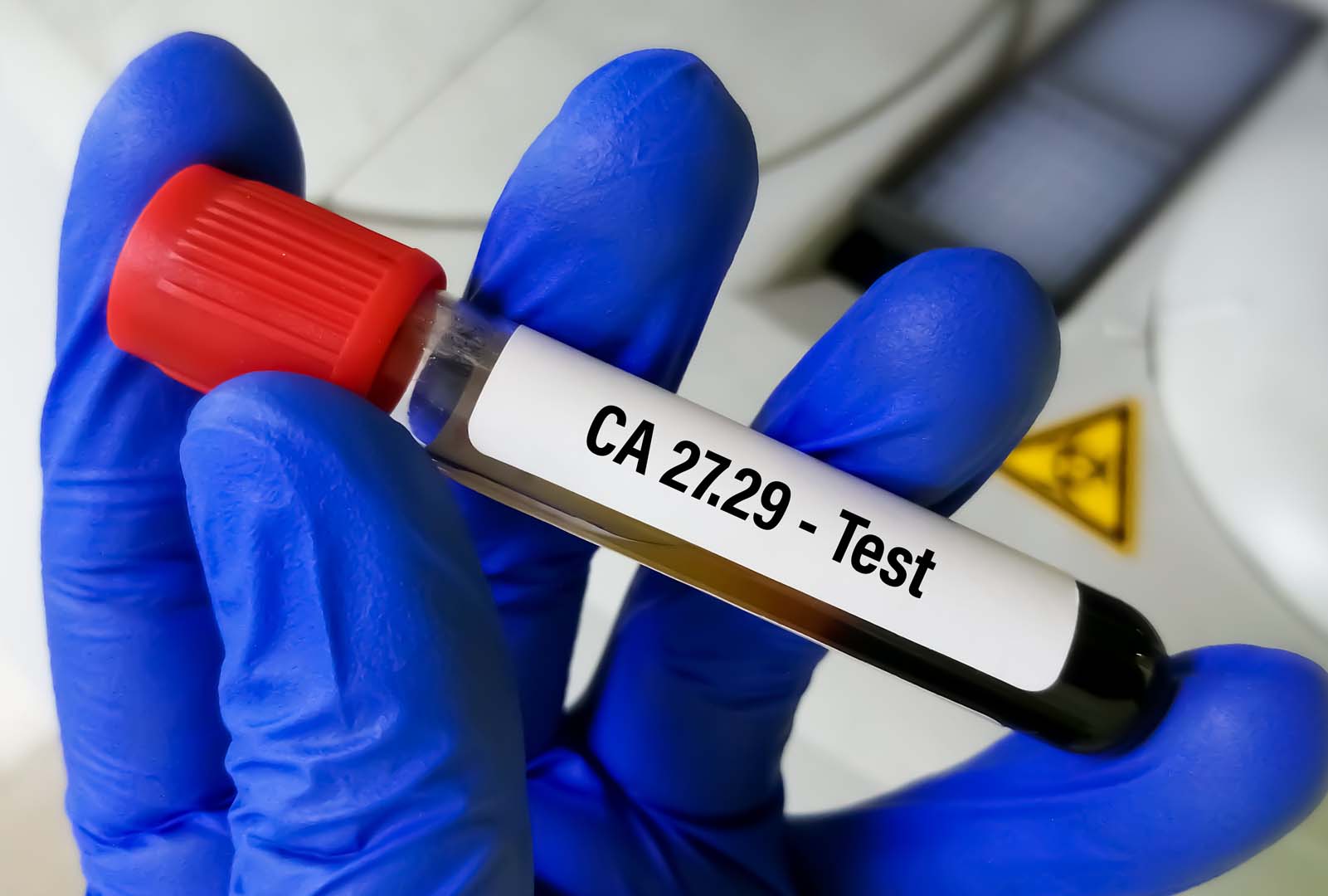 CA 125 Testi