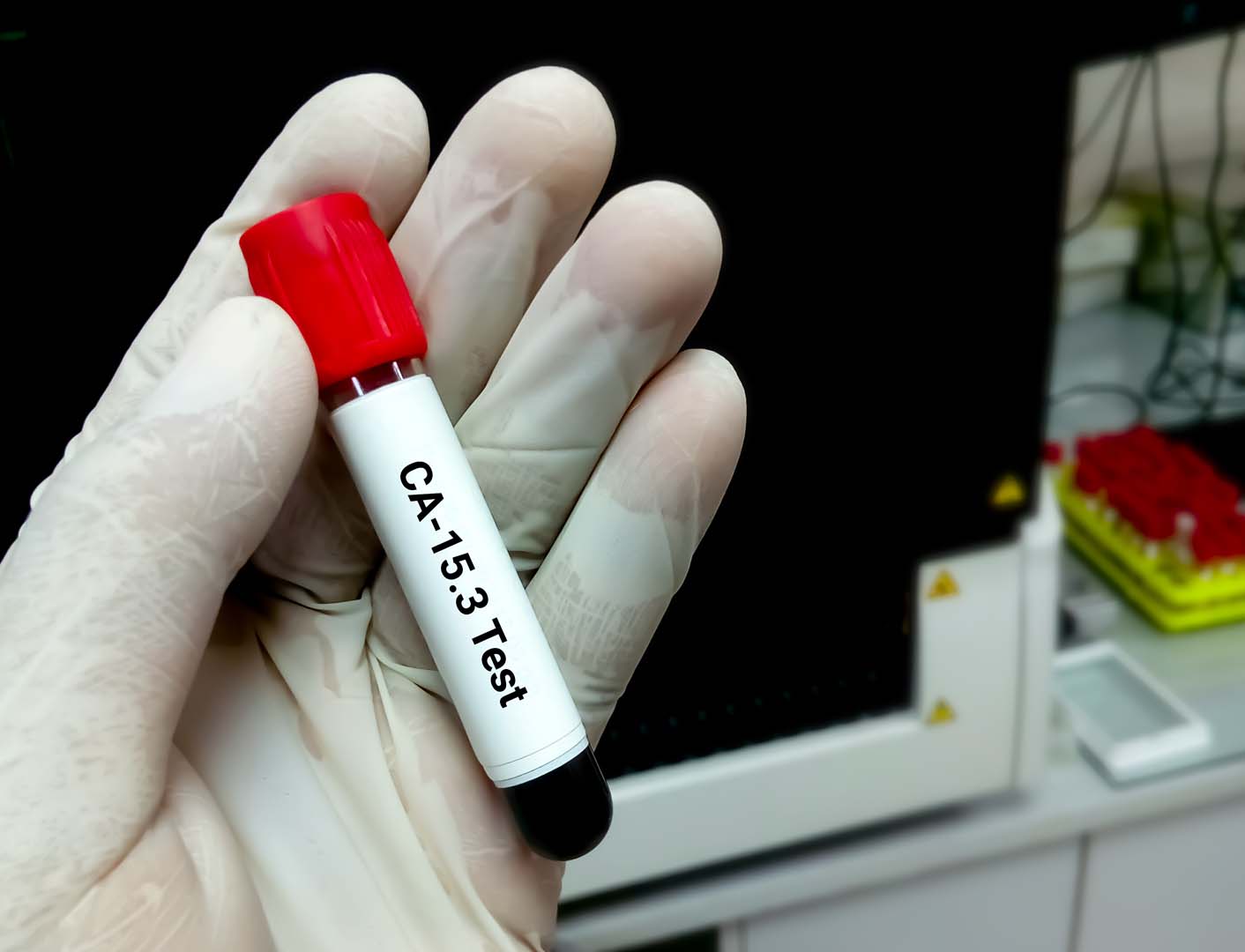 CA 15-3 Testi