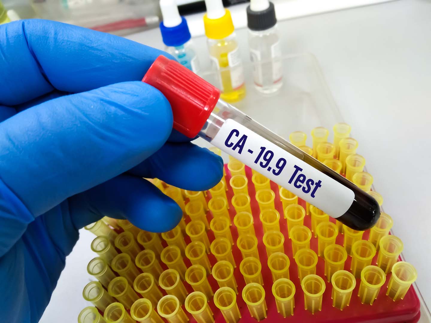 CA 19-9 Testi