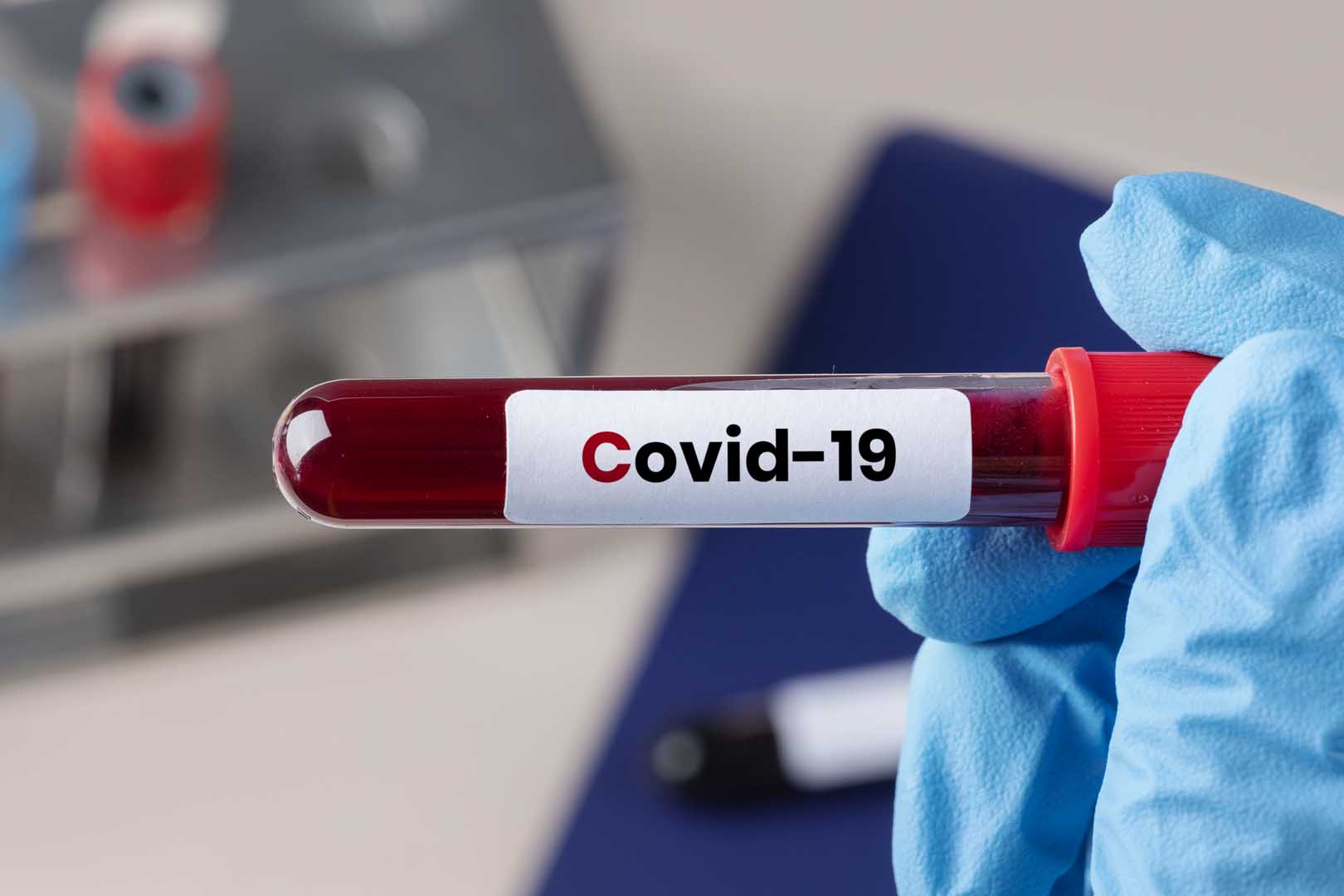 Covid-19 (Koronavirüs)
