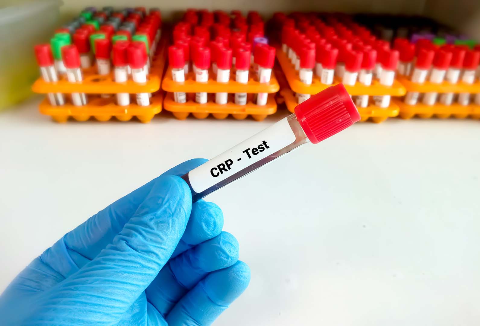 CRP Testi