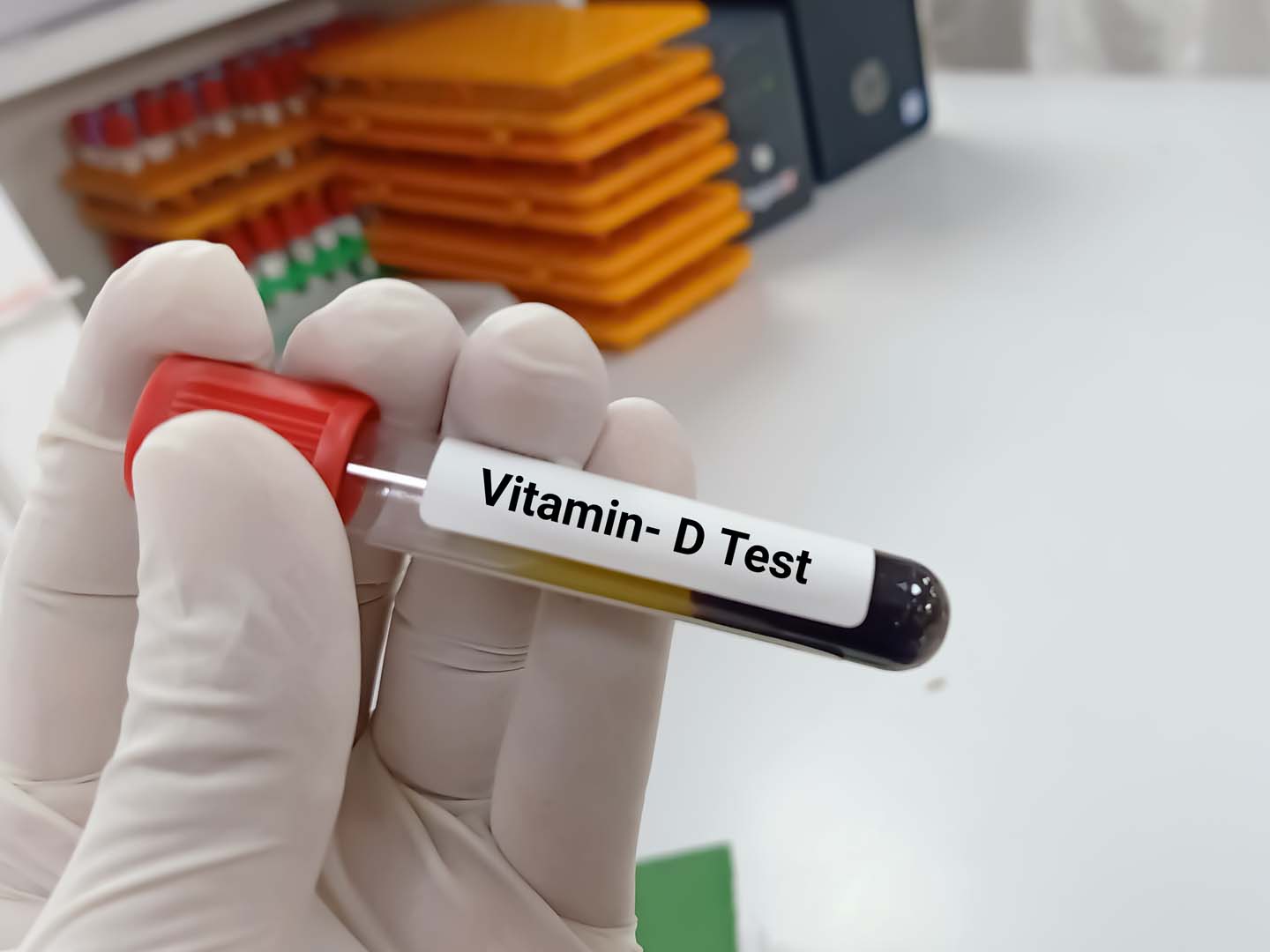 D Vitamini Testi