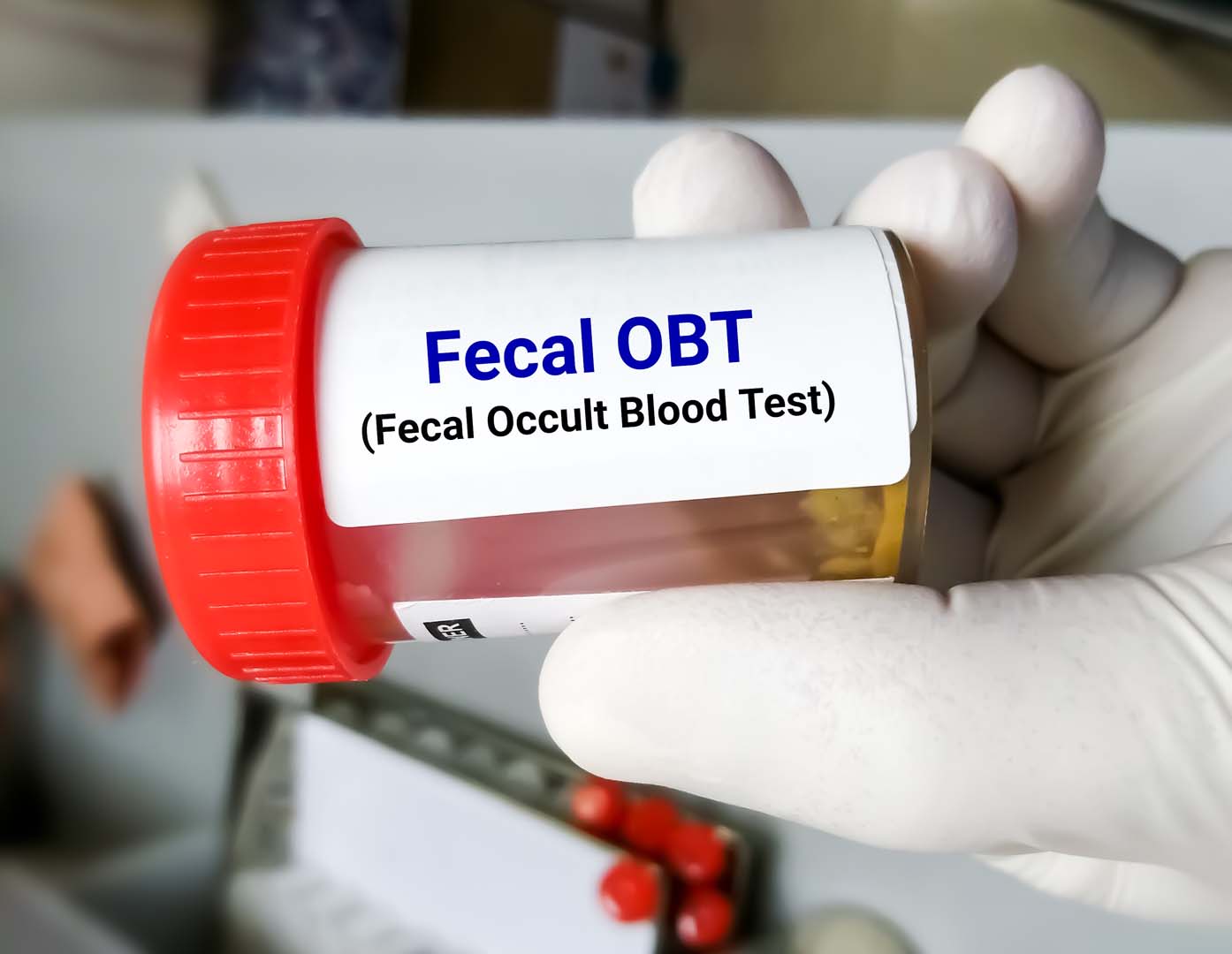 Dışkıda Gizli Kan Testi