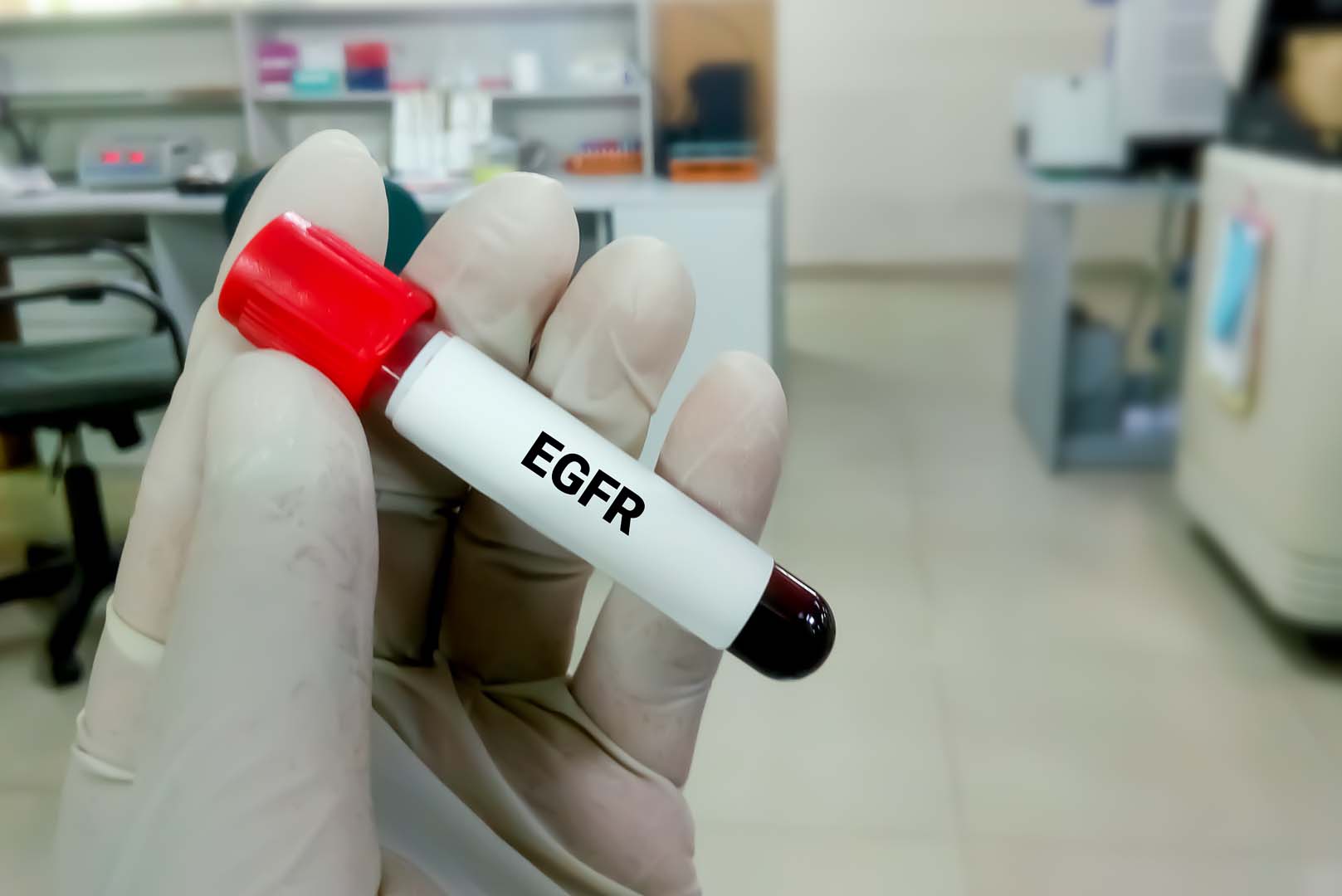 EGFR Testi