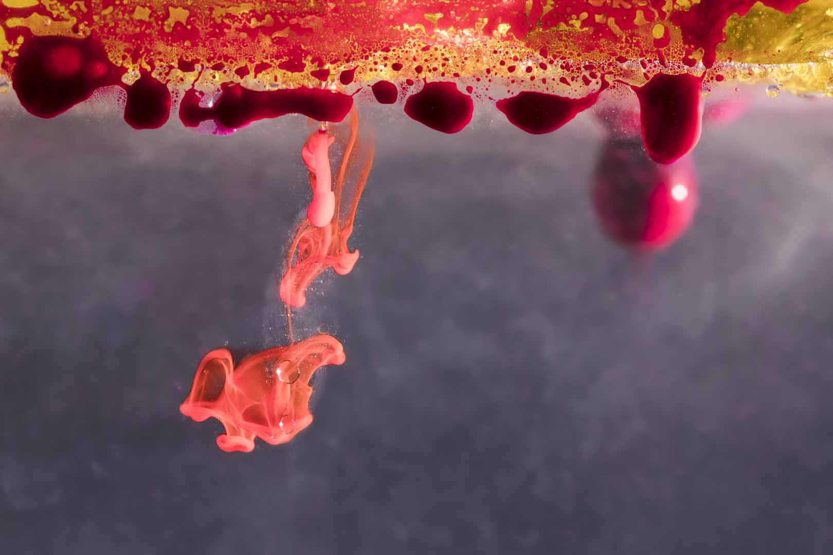Endovasküler Embolizasyon