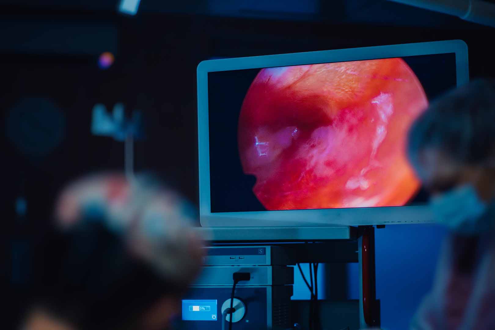 ERCP
