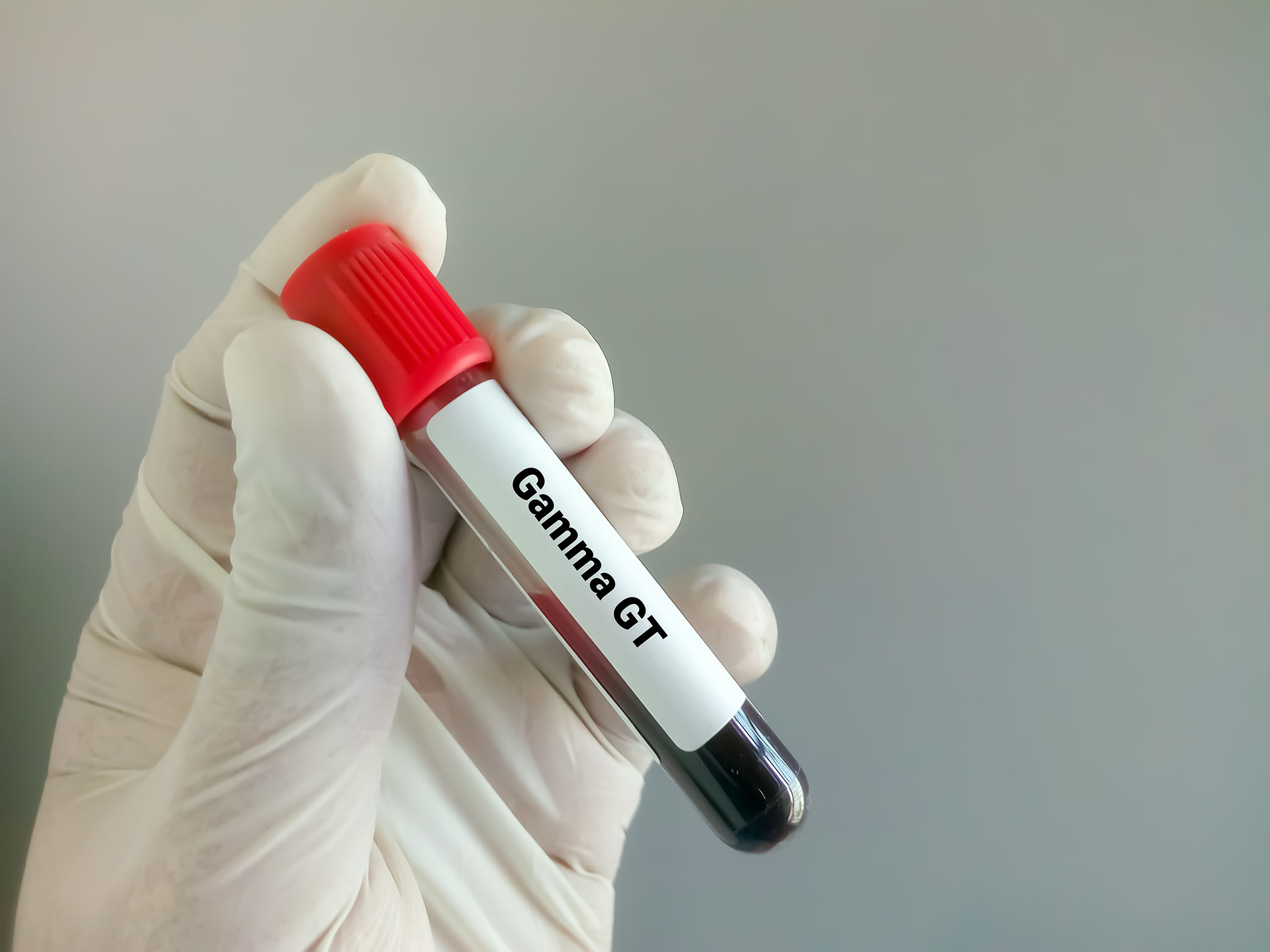 Gama Glutamil Transferaz (GGT) Testi