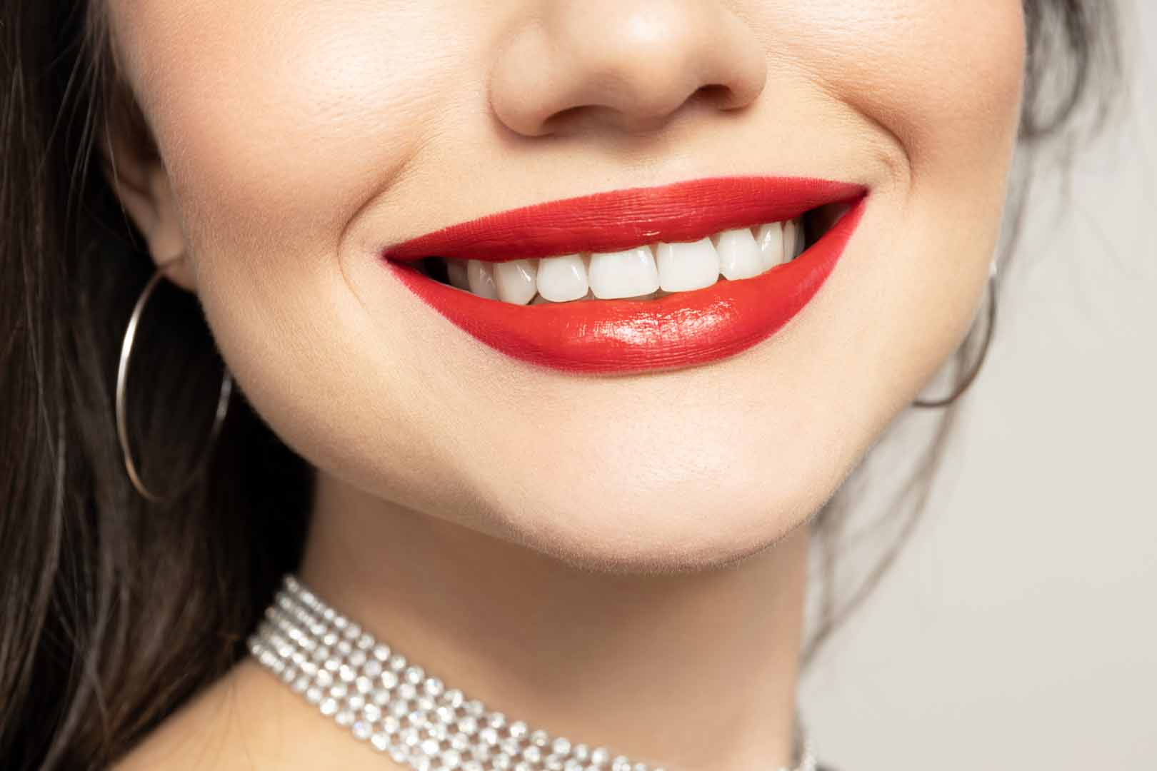 Gülüş Tasarımı (Hollywood Smile)