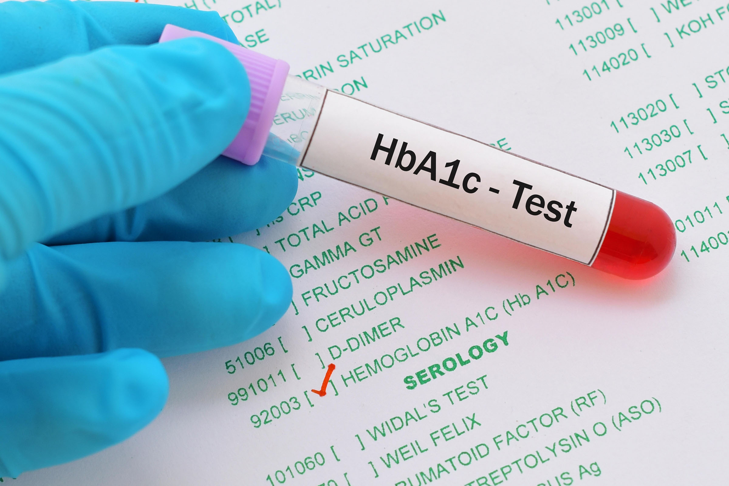 HbA1c Testi
