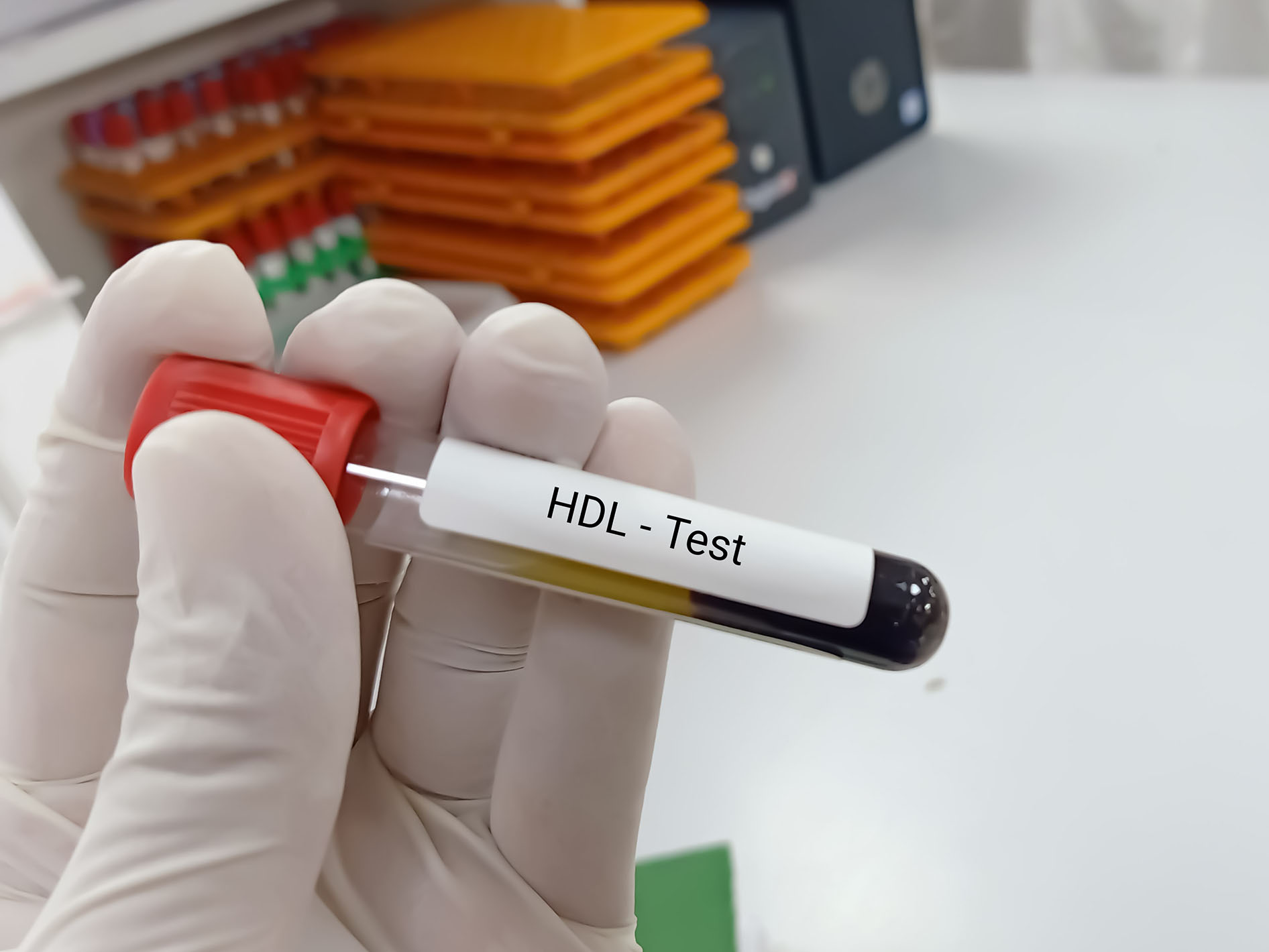 HDL Testi