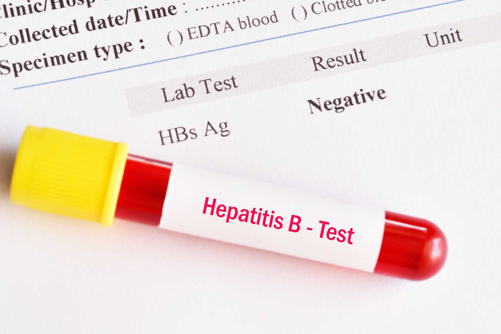 Hepatit B