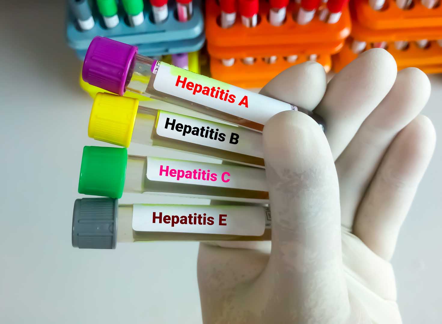 Hepatit E