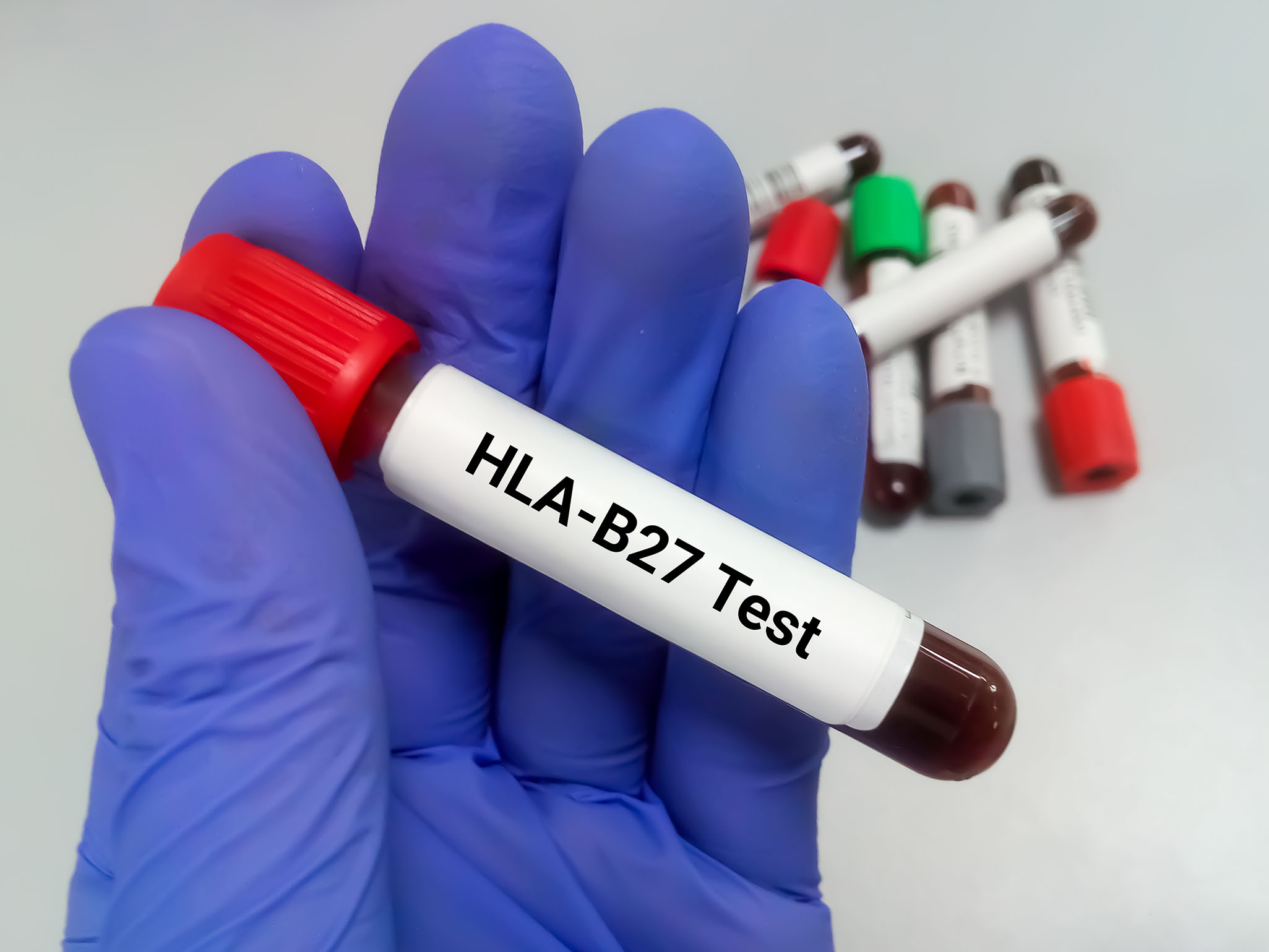 HLA B27 Testi