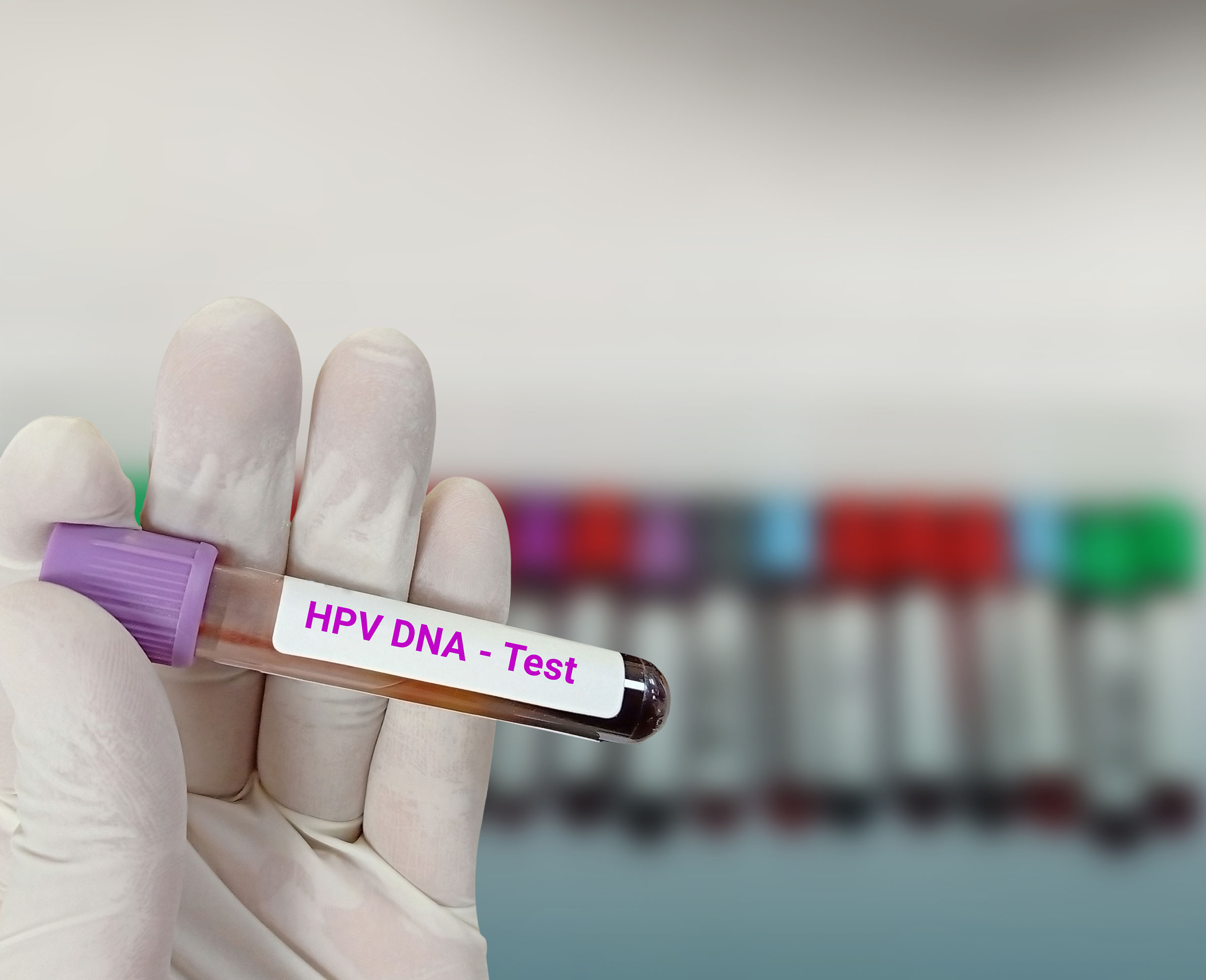 HPV DNA Testi