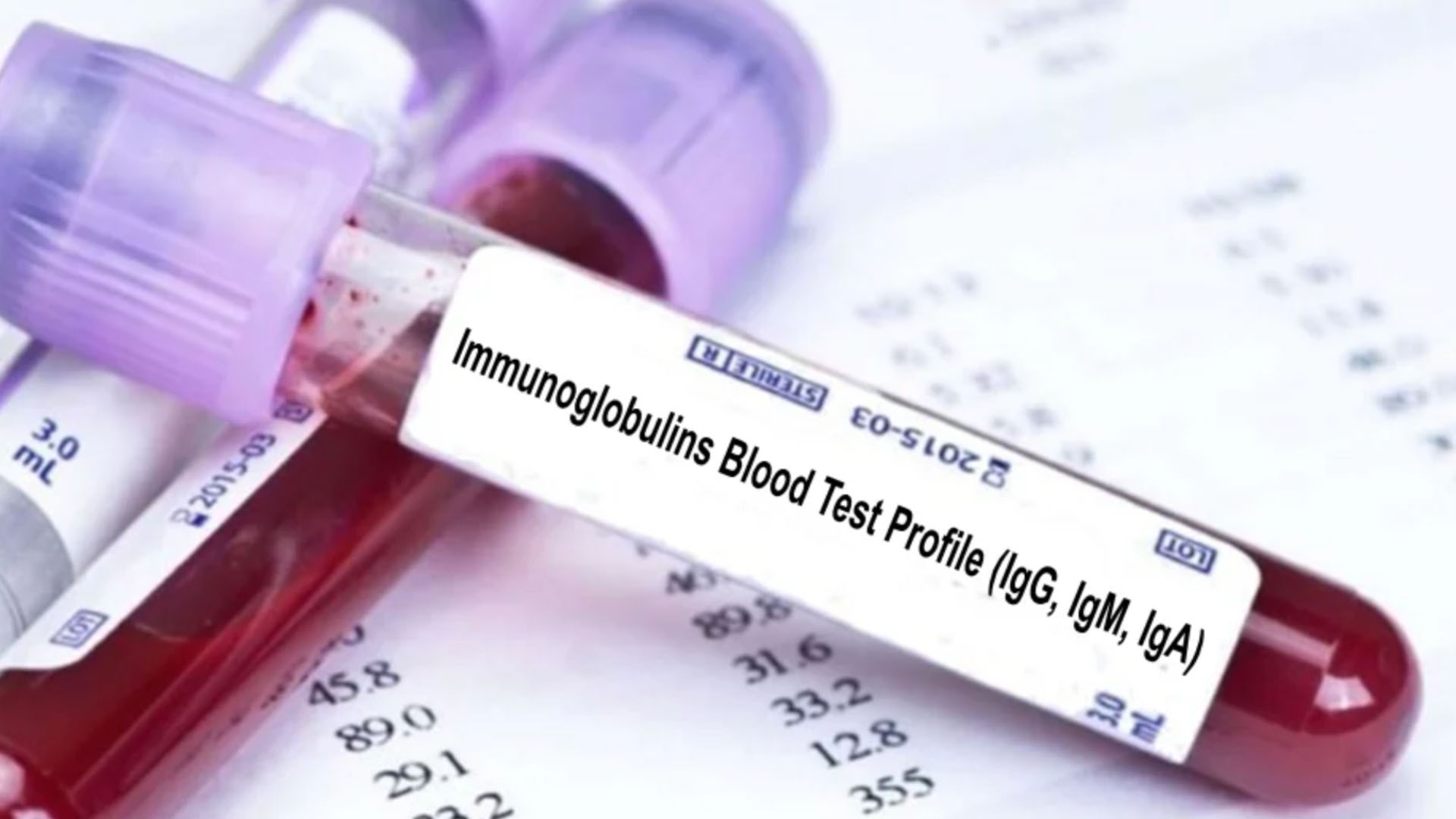 IG (İmmünoglobulin) Testi