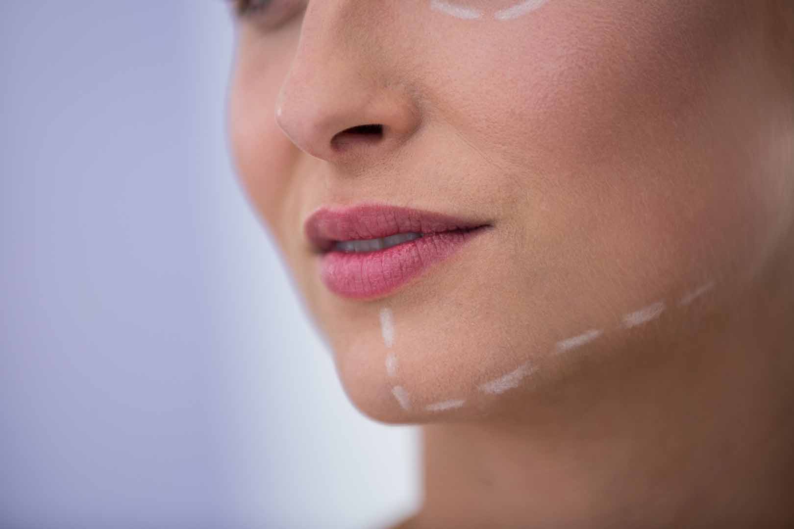 Jawline (Çene Hattı) Dolgusu
