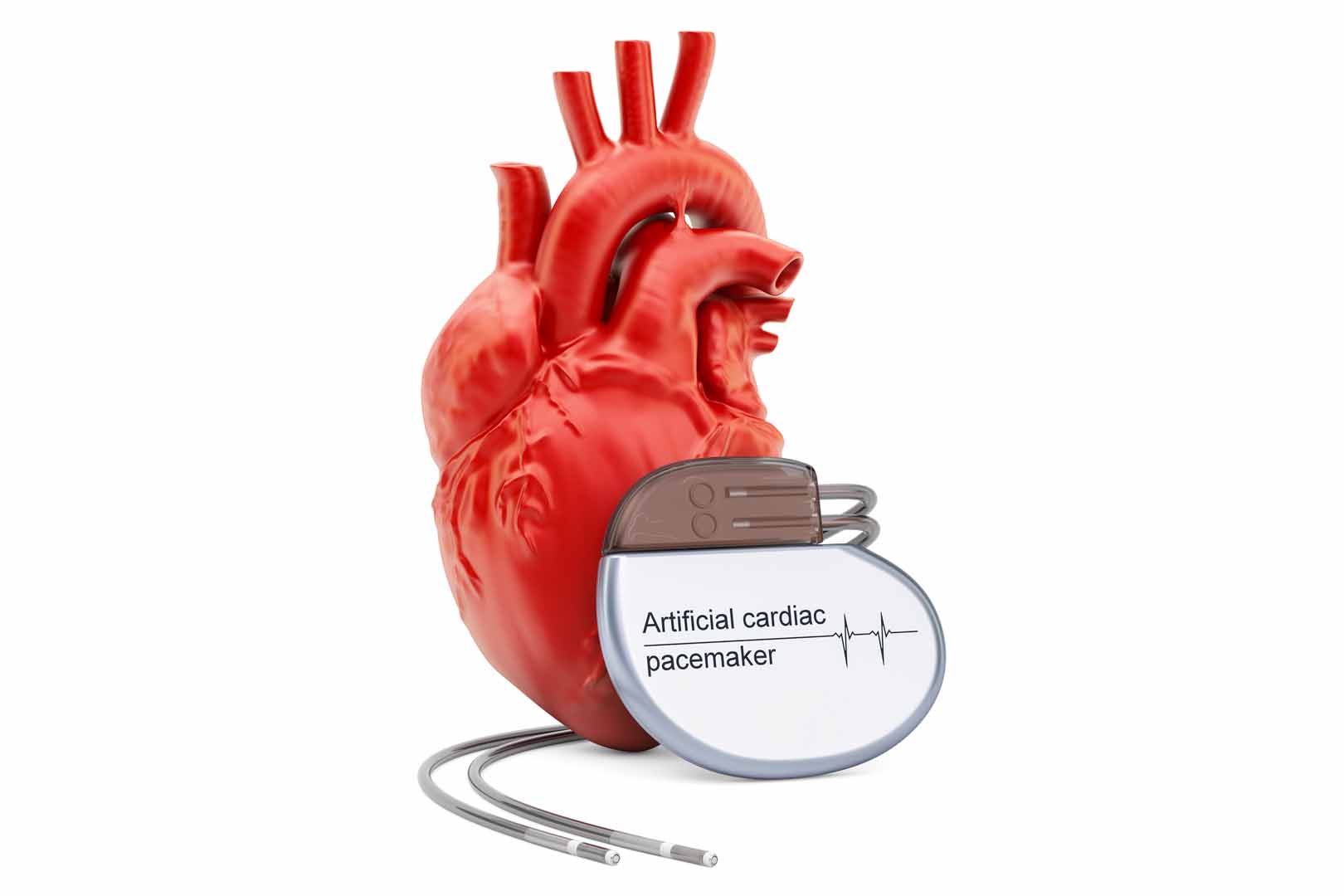 Kalp Pili (Kardiyak Pacemaker)