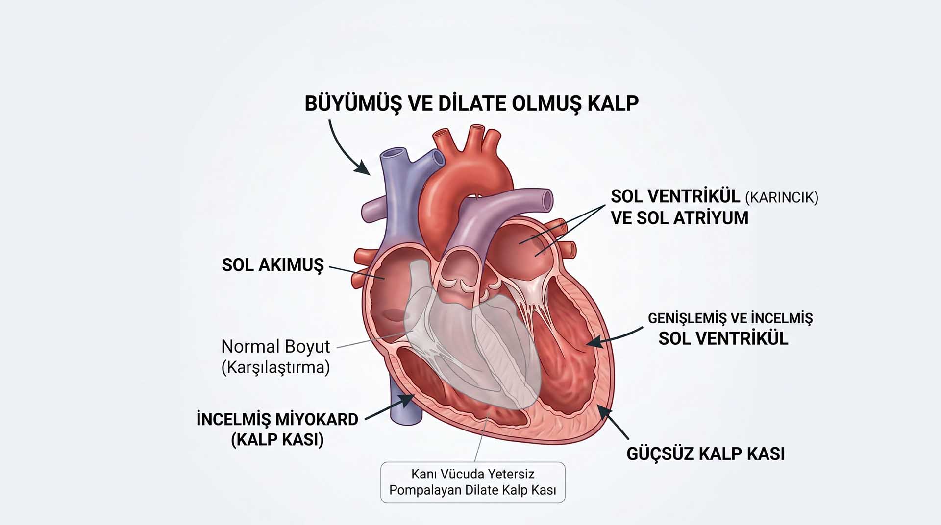 Kalp Yetmezliği