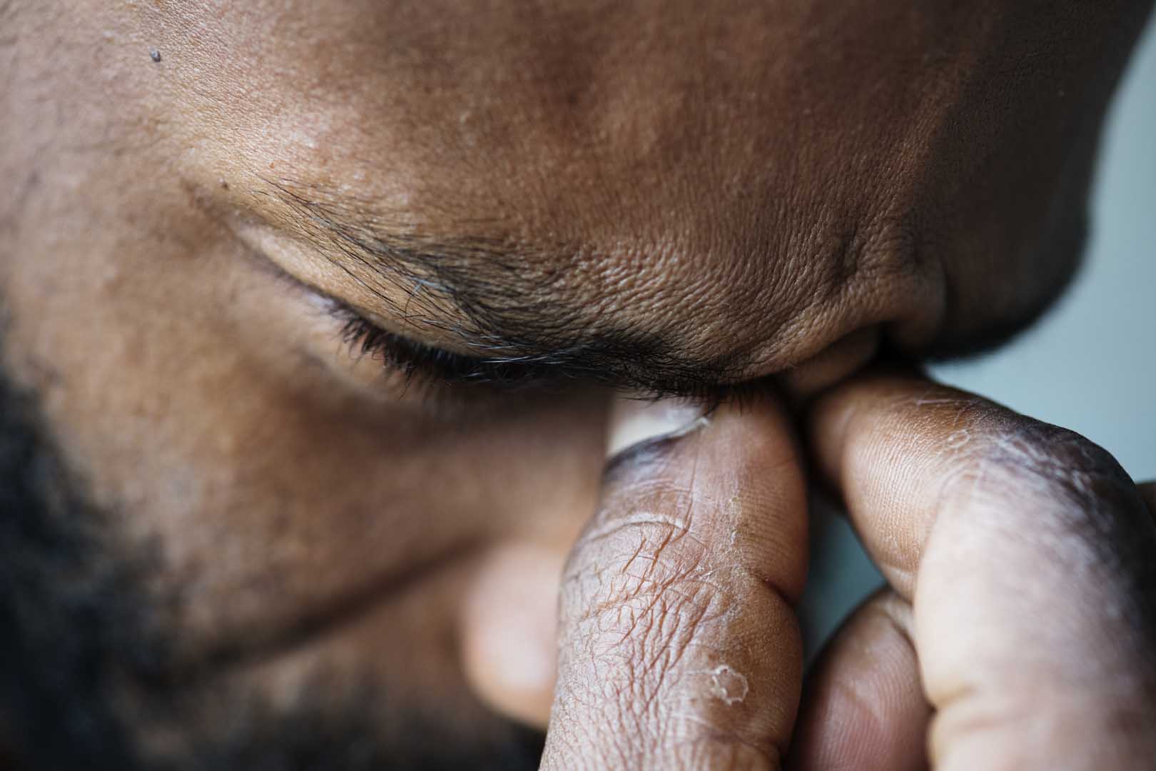 Kara Mantar Hastalığı