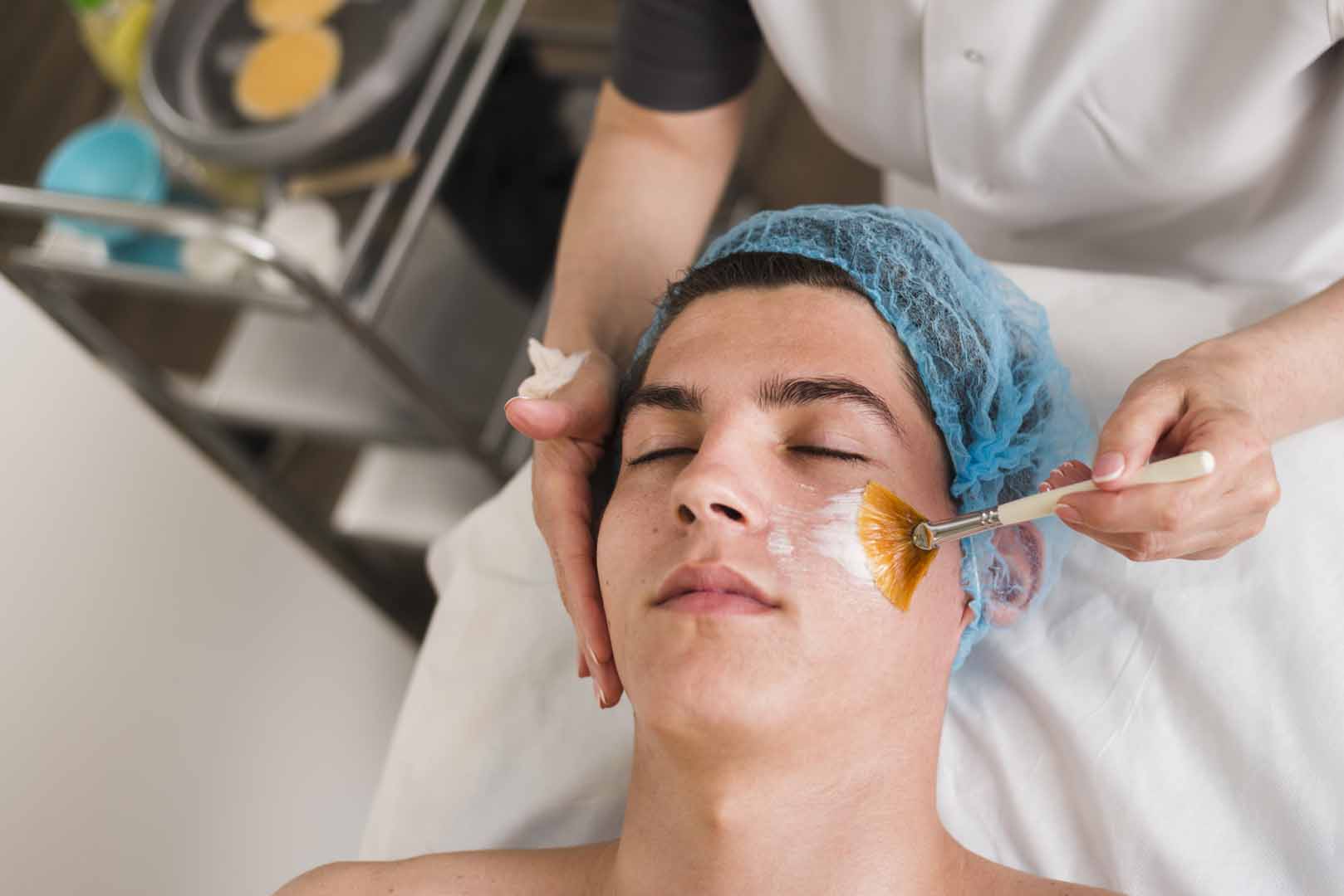 Kimyasal Peeling