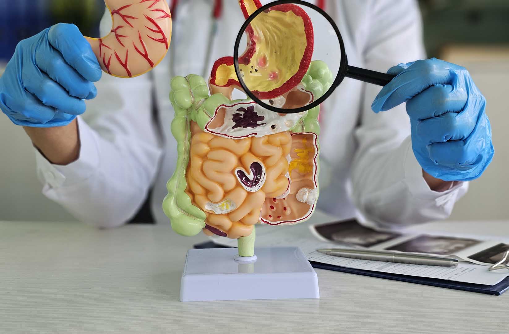 Kolit ve Ülseratif Kolit