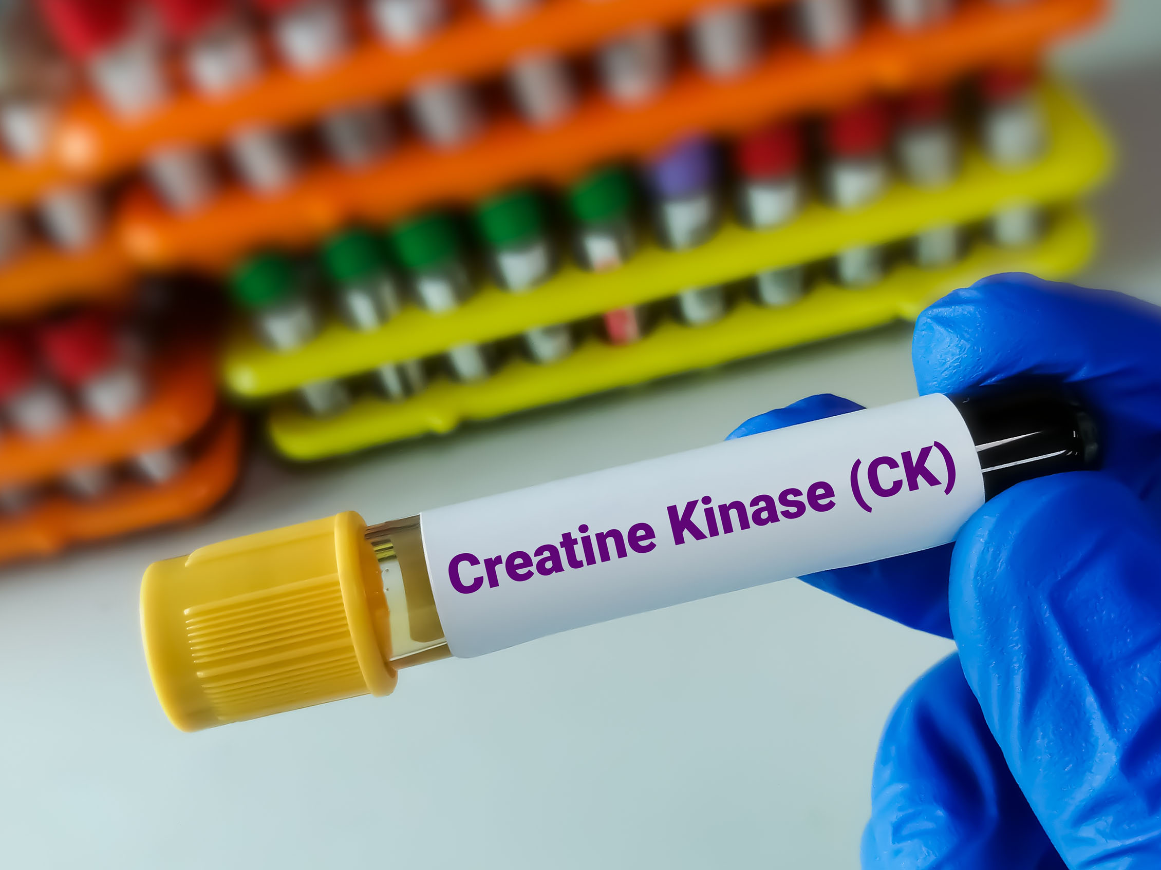 Kreatin Kinaz (CK)
