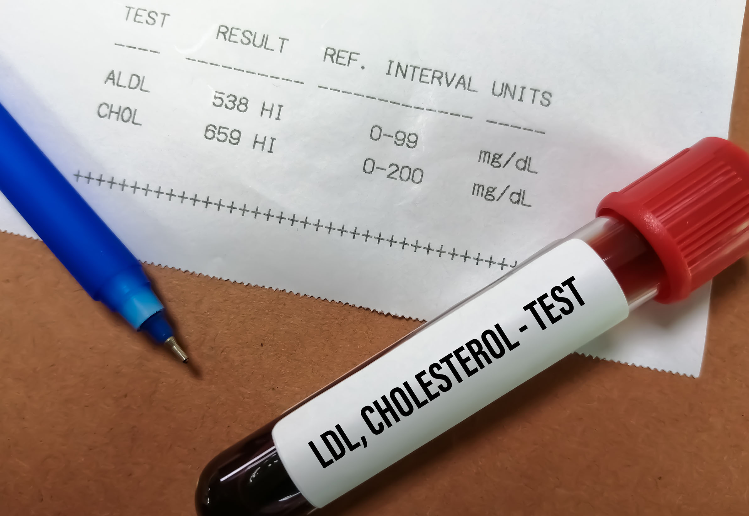 LDL Testi