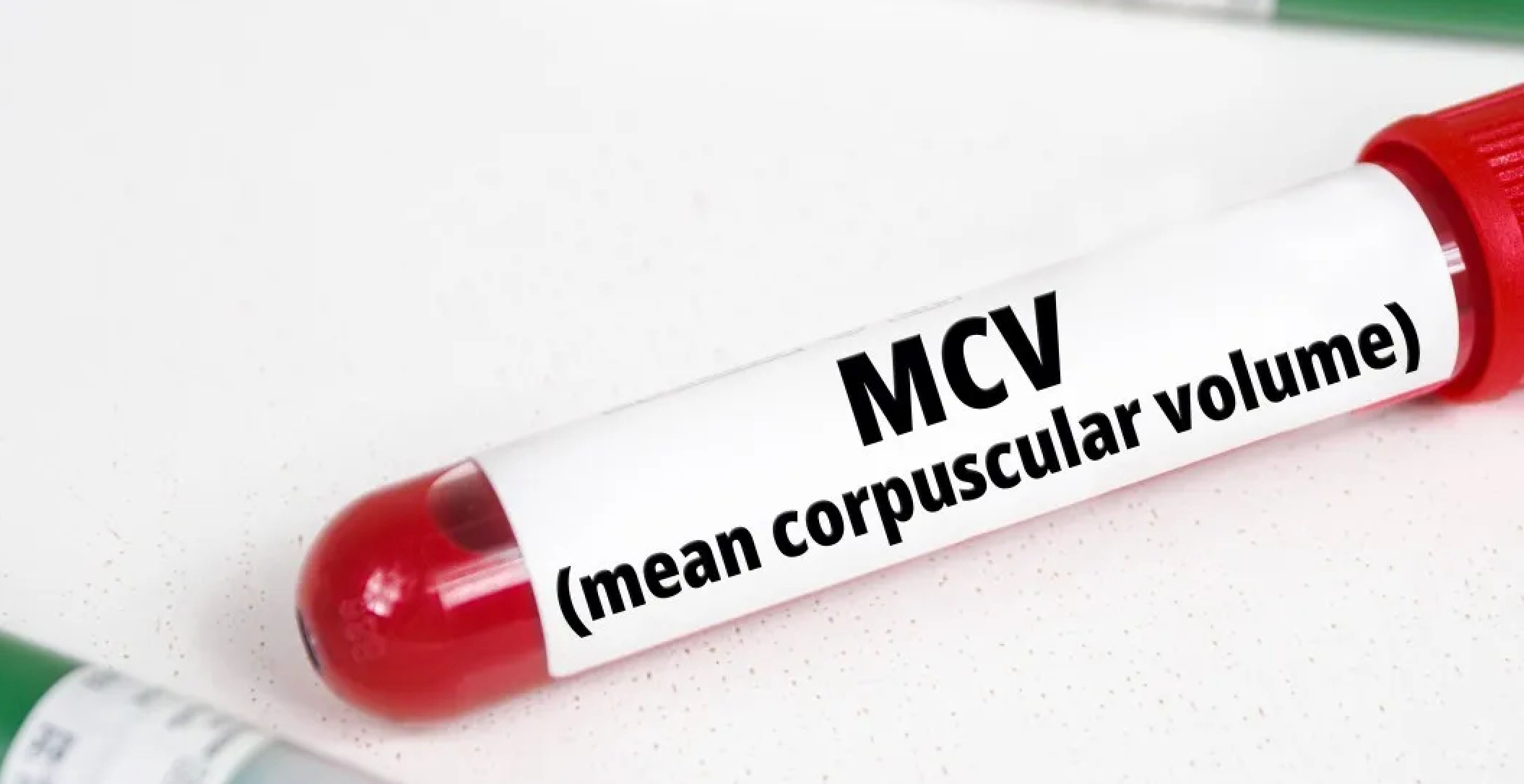 MCV Testi