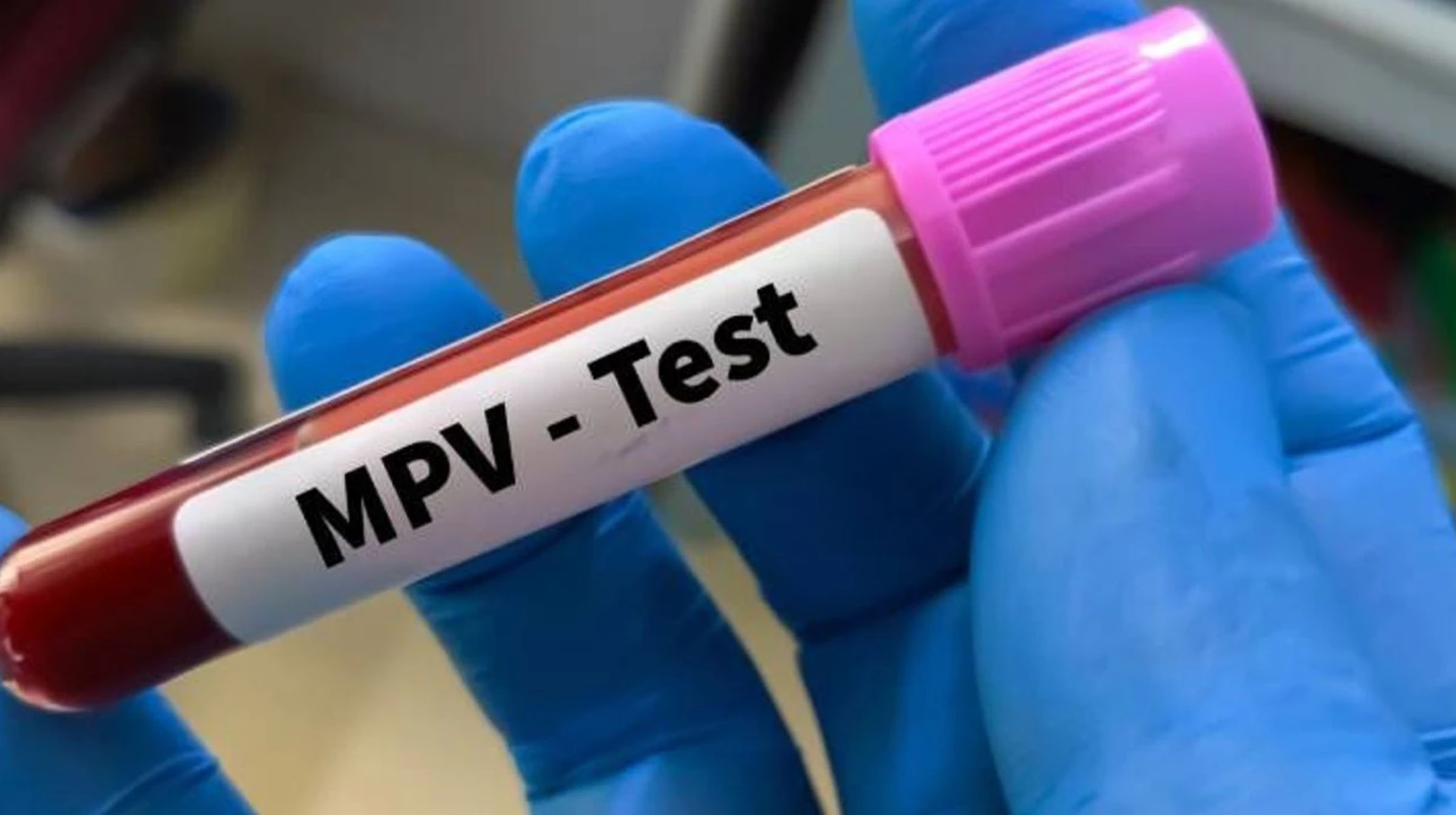 MPV Testi