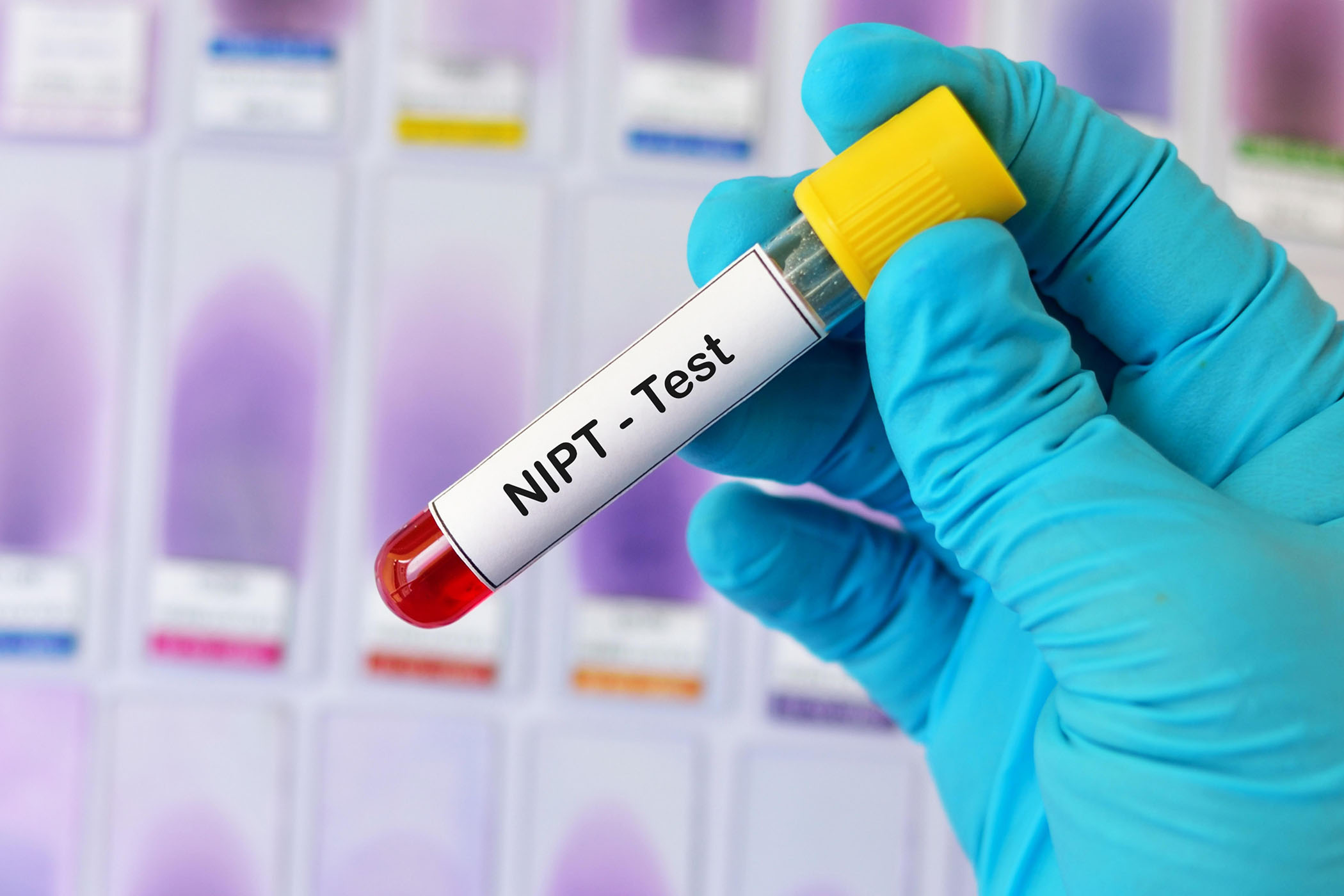 NIPT Testi