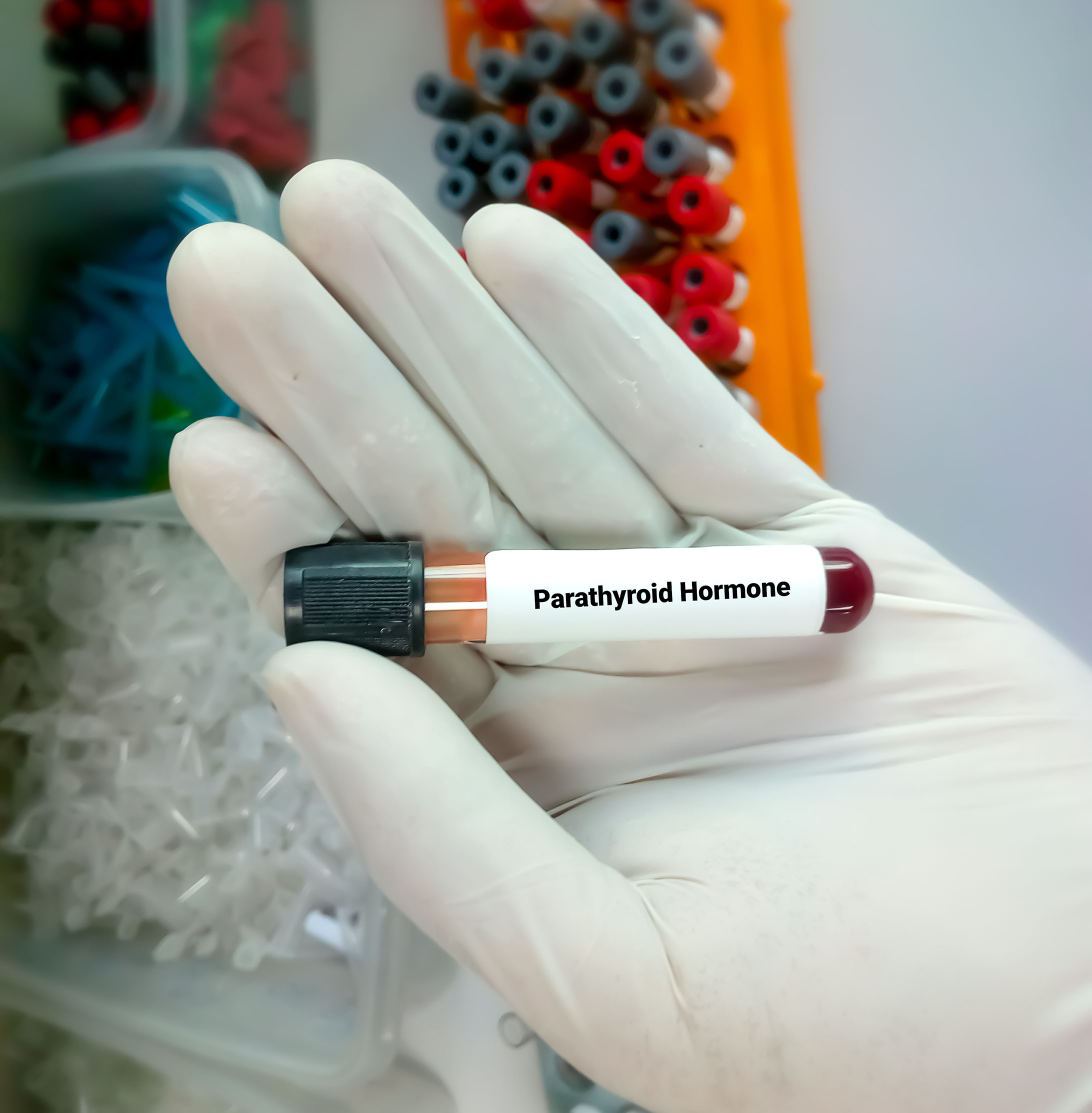 PTH Testi