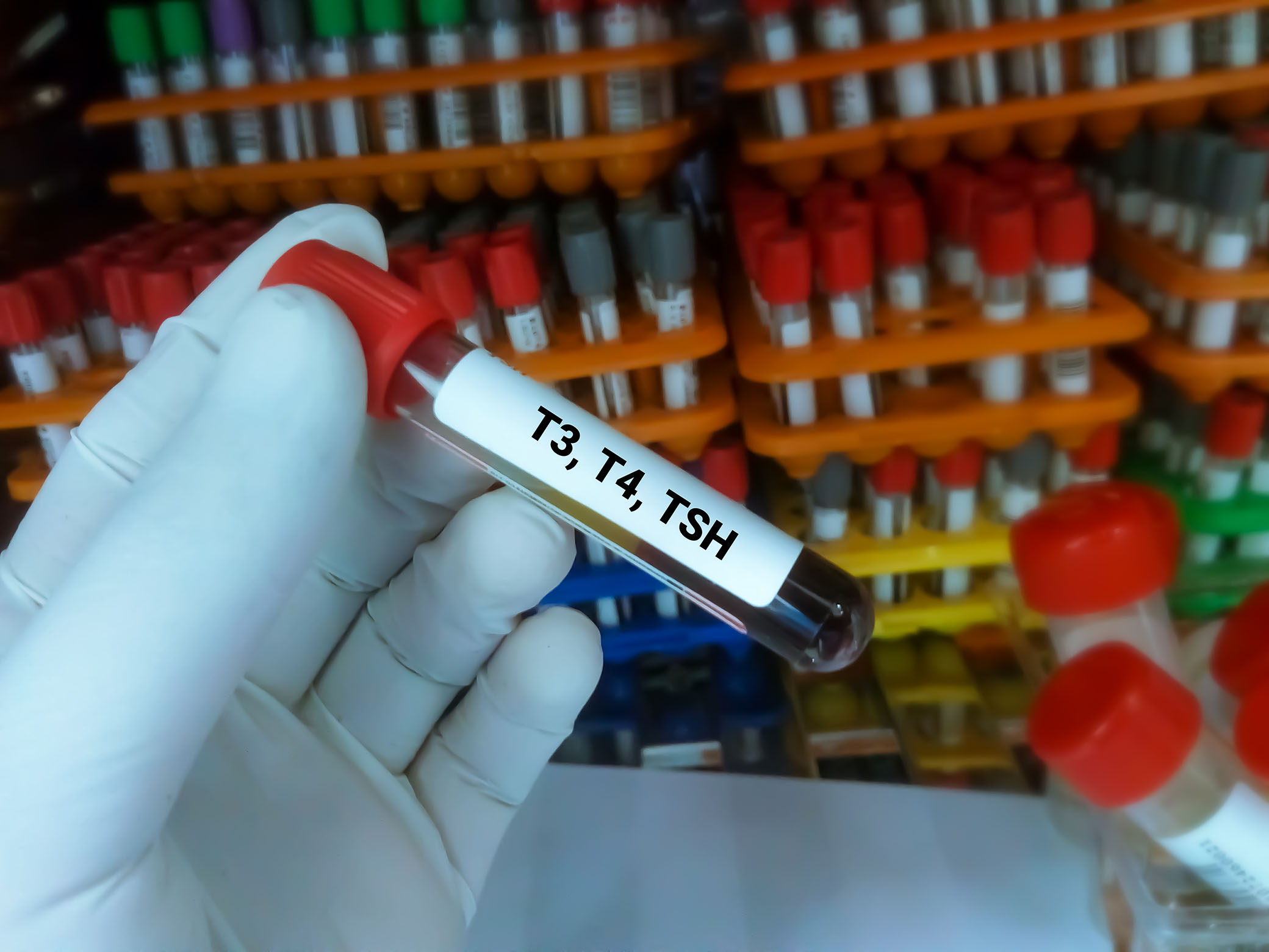 T3-T4 Testi