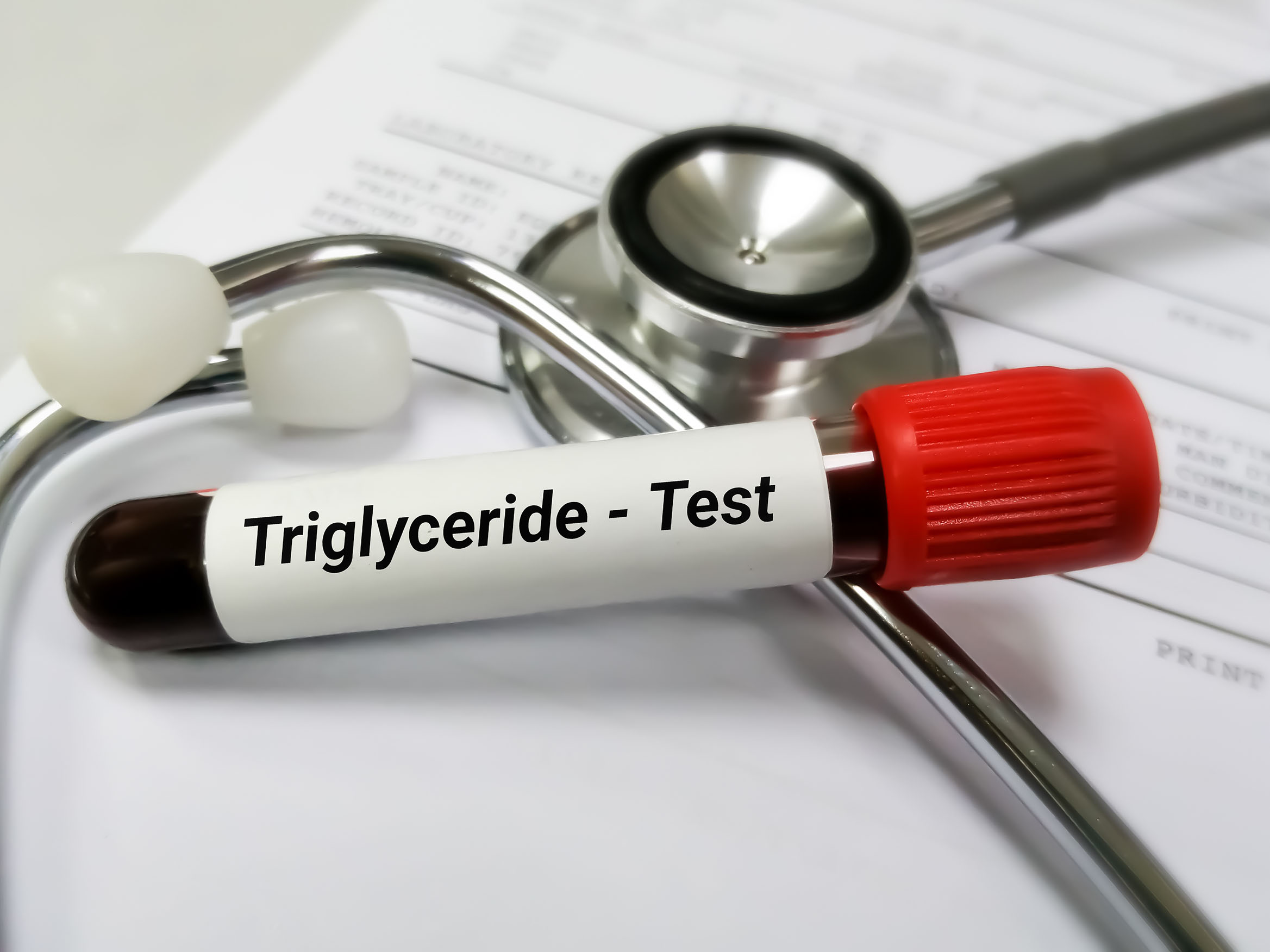 Trigliserid