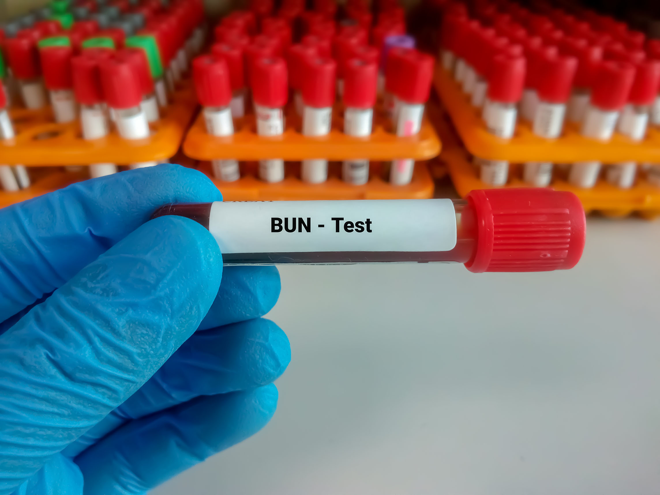 Üre (BUN Testi)