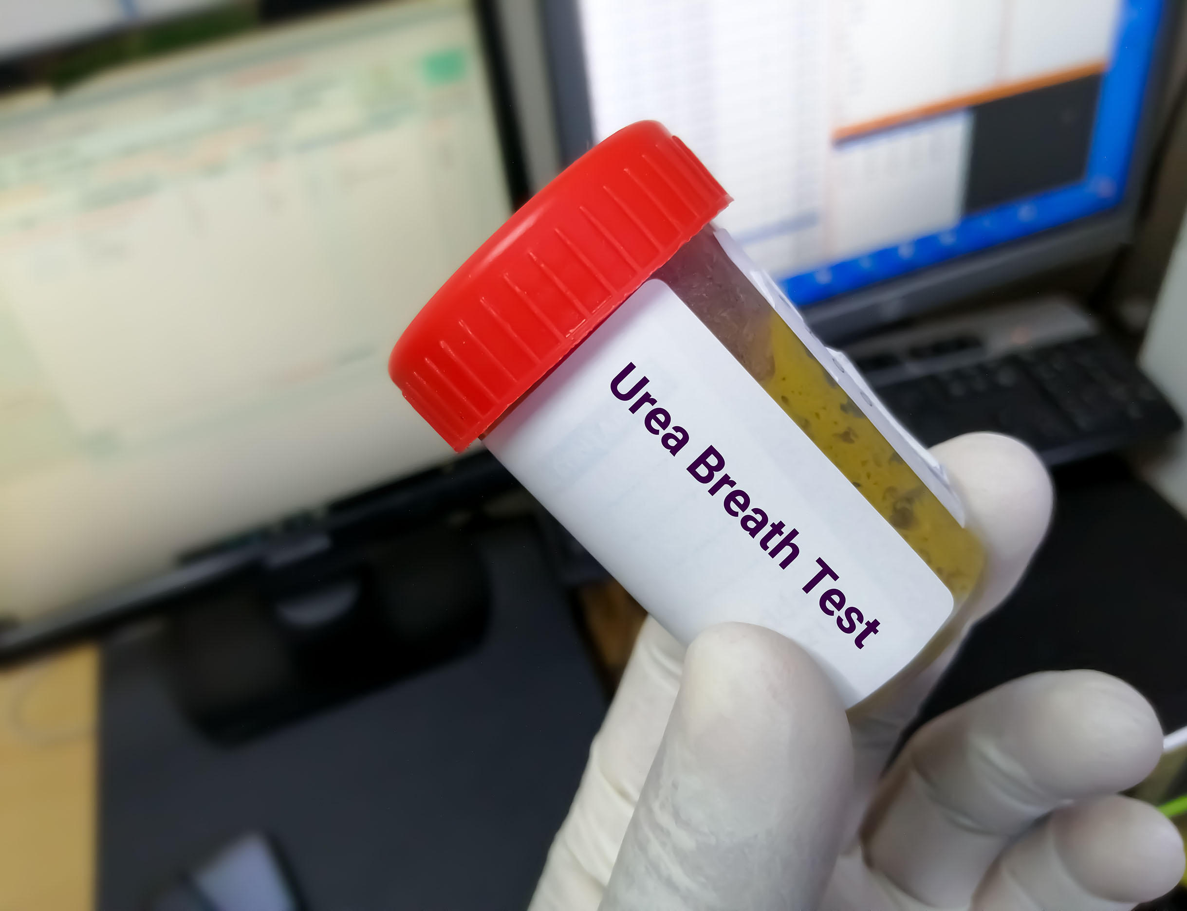 Üre Nefes Testi